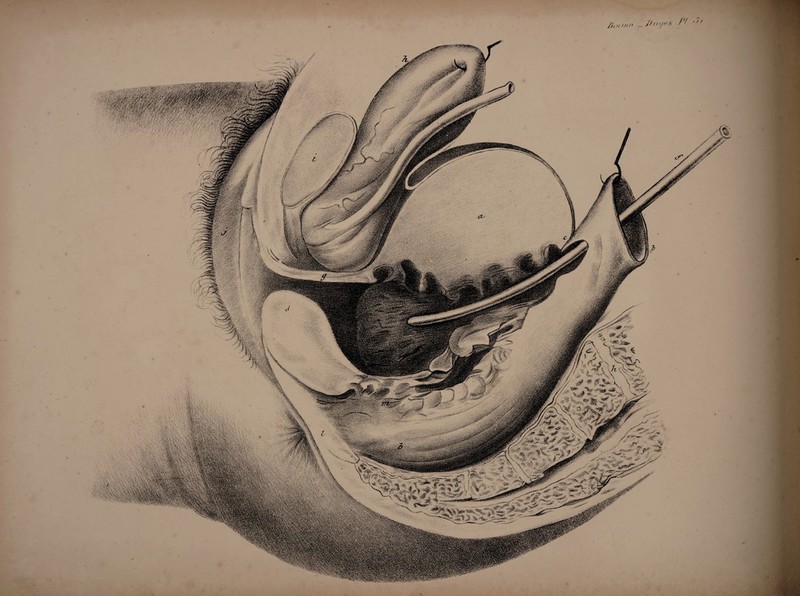 /)0( o/rt _? 7 y rs / t 'y/ %