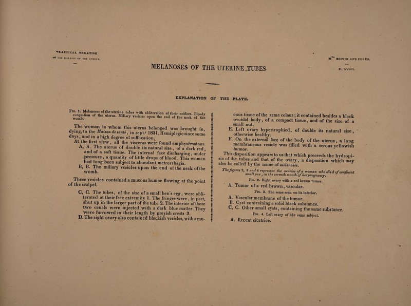 ^ T,l£ diseases ok the cxiars. MELANOSES OF THE UTERINE .TUBES- m1' EOIVIK AND BÜGÈ3. PL. nxm. EXPLANATION OF TOE PLATE. Fig. 1. Melanoses of the uterine tubes with obliteration of their orifices Bloodv t congesUon of the uterus. Mili.rjr vesicles upou the end of the neck’ of Z I womb. The woman to whom this uterus belonged was brought in dying, to the Mauon de santé, in sepf 1831. Hemiplegic since some days, and in a nigh degree of suffocation. AtAtheAfir^VVieW ’ 911 the viscer?s were found emphysématous. A, A. The uterus of double its natural size, of a dark red and of a soft tissue. The internal face discharging, under pressure , a quantity of little drops of blood. This woman had long been subject to abundant metrorrhagia. B, B. The miliary vesicles upon the end ol the neck of the womb. These vesicles contained a mucous humor flowing at the point of the scalpel. I C, G. The tubes, of the size of a small hen’s egg, were obli- ! terated at their free extremity 1. The fringes were , in part, g shut up in the larger part of the tube 2. The interior of these $ two canals were injected with a dark blue matter. They f were furrowed in their length by greyish crests 3. | D. The right ovary also contained blackish vesicles, with a mu- f cous tissue of the same colour ; it contained besides a black ovoidal body, of a compact tissue, and of the size of a small nut. E. Left ovary hypertrophied, of double its natural size, otherwise healthy. F. On the external face of the body of the uterus , a long membraneous vesicle was filled with a serous yellowish, humor. J This disposition appears to us that which preceeds the hydropi- sia of the tubes and that of the ovary, a disposition which may also he called by the name of melanoses. The figures 2, 3 and 4 represent the ovaries of a woman who died of confluent small pox j m the seventh month of her pregnancy. Fig. 2. Right ovary with a red brown tumor. A. Tumor of a red brown, vascular. Fig. 3. The same seen on its interior. A. Vascular membrane of the tumor. B. Cyst contraining a solid black substance. C. C. Other small cysts, containing the same substance. Fig. 4. Left ovary of the same subject. A. Recent cicatrice.