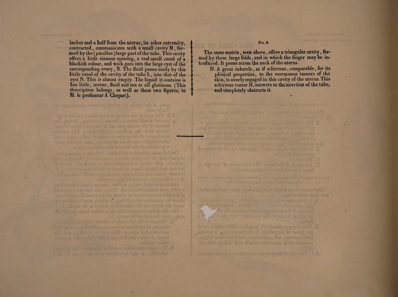 inches and a half from the uterus ; its other extremity, contracted, communicates with a small cavity M, for- i1 med by the (pavilion ) large part of the tube. This cavity 1 ! offers a little sinuous opening, a real small canal of a | blackish colour, and wich goes into the large cyst of the i ; corresponding ovary , N. The fluid passes easily by this ij little canal of the cavity of the tube L, into that of the j> cyst N. This is almost empty. The liquid it contains is ! but little, serous, fluid and not at all glutinous. (This ! description belongs, as well as these two figures, to !' M. le professeur J. Cloquet). 1 Fig. 3. The same matrix, seeti above, offers a triangular cavity, for¬ med by three large folds, and in which the finger may be in¬ troduced. It passes across the neck of the uterus. H. A great tubercle, as if schirrous, comparable, for its phisical properties, to the verrucuous tumors of the skin, is nearly engaged in this cavity of the uterus. This schirrous tumor H, answers to the insertion of the tube, and completely obstructs it.