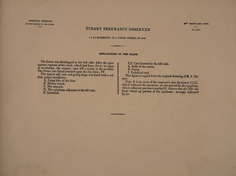 ■OP THE DISEASES OF THB UTERU8, ume SOIVIN AMD LUGES TUBARY PREGNANCY OBSERVED ( A LA MATERNITÉ) IN A YOUNG WOMAN, IN 18ift. EXPLANATION OP THE PLATE, The foetus was developped in the left tube. After the spon- taneous rupture of the canal, which had been, for it, an organ of incubation, the woman, soon fell a victim to the accident. The foetus was found situated upon the iliac fossa, FF. The matrix soft, red, and pretty large, was lined with a red¬ dish, pulpy membrane. A. Large lobe of qhe liver. B. Biliary vesicle. C. The stomach. D. The epiploom adherent to the left tube. E. Intestines. IF,F. Cyst formed by the left tube. G. Body of the uterus. H. Foetus. I. Umbilical cord. !’ figure is copied from the original drowing of M. J. Clo- <IUC t. Nütci. It is an error of the engraver’s that the letters C,C,C. | which indicates the intestines, are also placed for the epiploom, | whose adherent portion is marked D. observe also of a DD, the | large raised up portion of the epiploom, wrongly indicated * by e,e. °