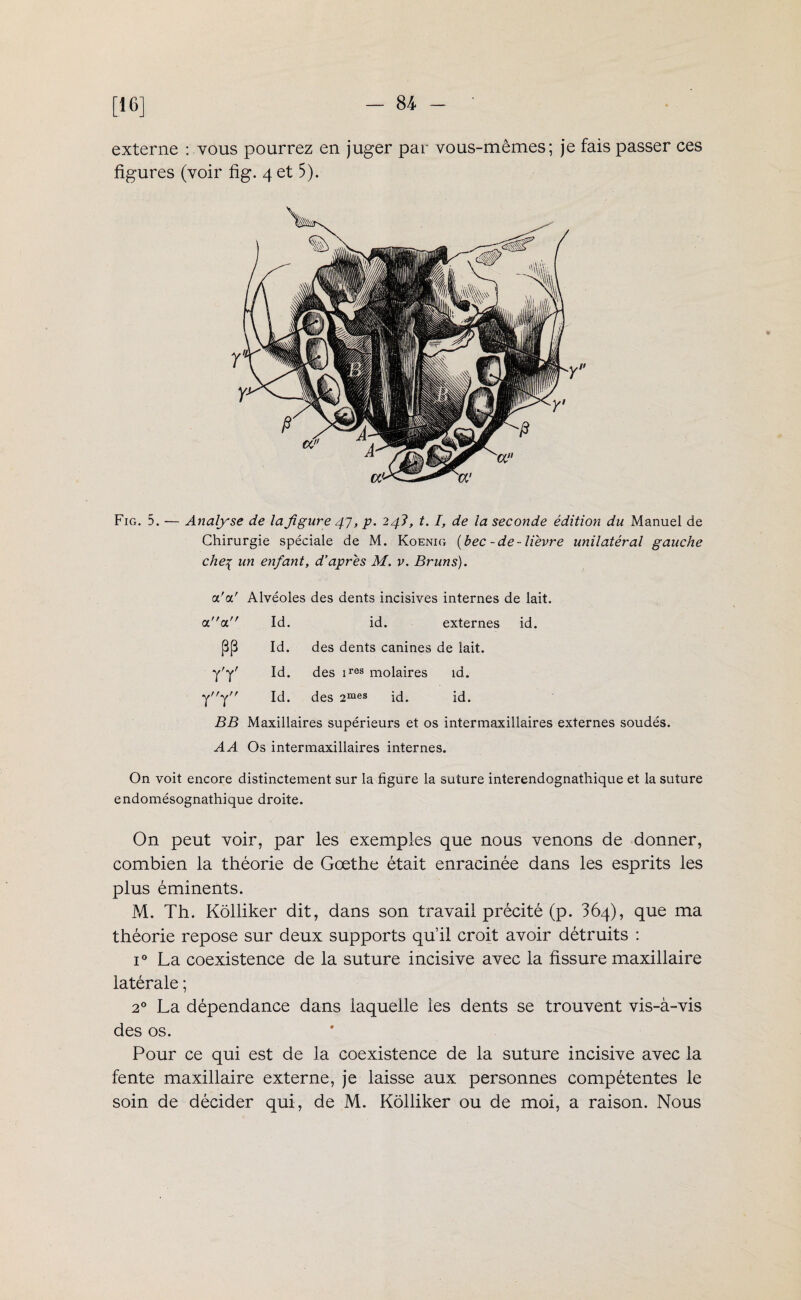 [16] externe : vous pourrez en juger par vous-mêmes; je fais passer ces figures (voir fig. 4 et 5). Fig. 5. — Analyse de la figure 47, p. 24?, t. I, de la seconde édition du Manuel de Chirurgie spéciale de M. Koenig (bec - de-lièvre unilatéral gauche chep un enfant, d’apres M. v. Bruns). a'cl' Alvéoles des dents incisives internes de lait. Id. id. externes id. Id. des dents canines de lait. Id. des ires molaires id. Id. des 2mes id. id. BB Maxillaires supérieurs et os intermaxillaires externes soudés. AA Os intermaxillaires internes. On voit encore distinctement sur la figure la suture interendognathique et la suture endomésognathique droite. On peut voir, par les exemples que nous venons de donner, combien la théorie de Goethe était enracinée dans les esprits les plus éminents. M. Th. Kôlliker dit, dans son travail précité (p. 364), que ma théorie repose sur deux supports qu’il croit avoir détruits : i° La coexistence de la suture incisive avec la fissure maxillaire latérale ; 20 La dépendance dans laquelle les dents se trouvent vis-à-vis des os. Pour ce qui est de la coexistence de la suture incisive avec la fente maxillaire externe, je laisse aux personnes compétentes le soin de décider qui, de M. Kôlliker ou de moi, a raison. Nous aa PP yY
