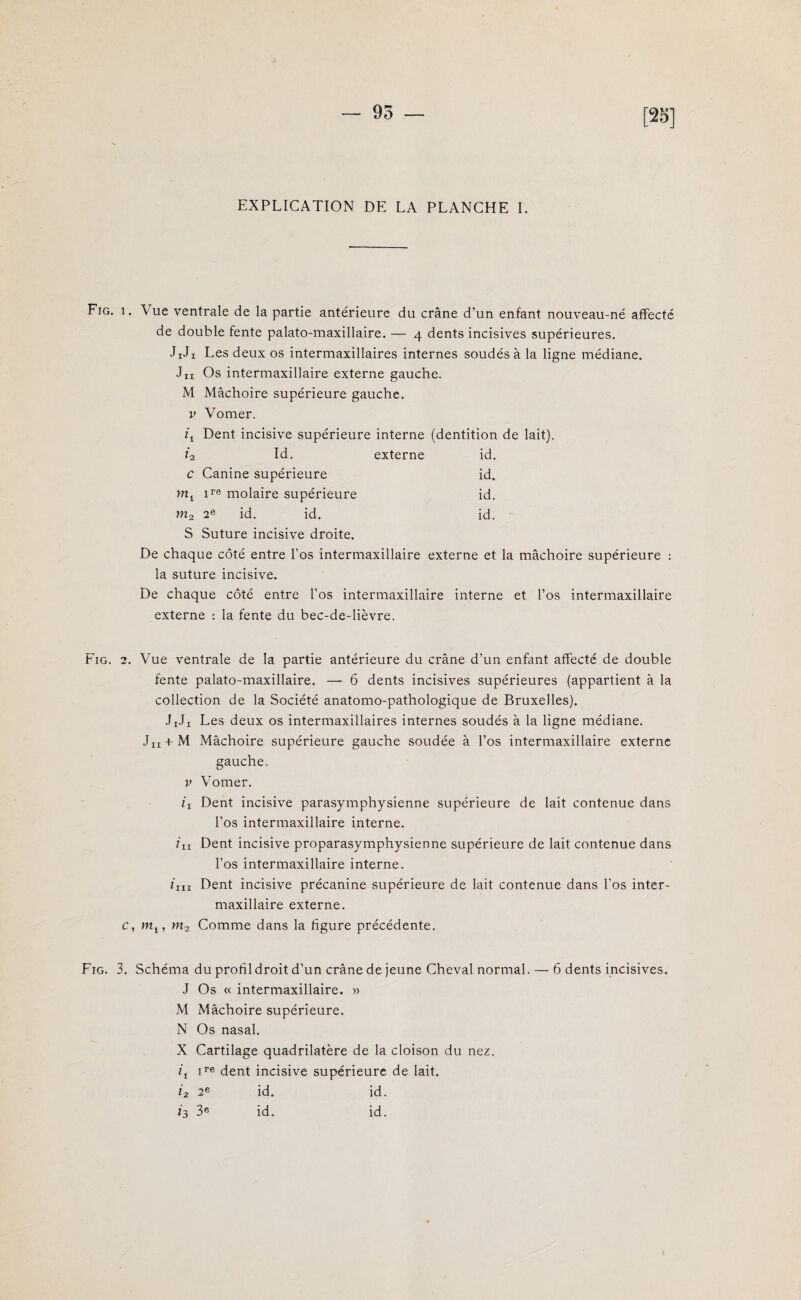 93 [25] EXPLICATION DE LA PLANCHE I. Fig. i. Aue ventrale de la partie antérieure du crâne d’un enfant nouveau-né affecté de double fente palato-maxillaire. — 4 dents incisives supérieures. JiJx Les deux os intermaxillaires internes soudés à la ligne médiane. Jn Os intermaxillaire externe gauche. M Mâchoire supérieure gauche. v Vomer. il Dent incisive supérieure interne (dentition de lait). *2 Id. externe id. c Canine supérieure id. mt ire molaire supérieure id. m2 2e id. id. id. S Suture incisive droite. De chaque côté entre l'os intermaxillaire externe et la mâchoire supérieure : la suture incisive. De chaque côté entre l’os intermaxillaire interne et l’os intermaxillaire externe : la fente du bec-de-lièvre. Fig. 2. Vue ventrale de la partie antérieure du crâne d’un enfant affecté de double fente palato-maxillaire. — 6 dents incisives supérieures (appartient à la collection de la Société anatomo-pathologique de Bruxelles). JxJx Les deux os intermaxillaires internes soudés à la ligne médiane. Jn + M Mâchoire supérieure gauche soudée à l’os intermaxillaire externe gauche. v Vomer. ii Dent incisive parasymphysienne supérieure de lait contenue dans l’os intermaxillaire interne. ilz Dent incisive proparasymphysienne supérieure de lait contenue dans l’os intermaxillaire interne. /m Dent incisive précanine supérieure de lait contenue dans l’os inter¬ maxillaire externe. c, mt, m2 Comme dans la figure précédente. Fig. 3. Schéma du profil droit d’un crâne de jeune Cheval normal. — 6 dents incisives. J Os « intermaxillaire. » M Mâchoire supérieure. N Os nasal. X Cartilage quadrilatère de la cloison du nez. q ire dent incisive supérieure de lait. *2 2e id. id. *3 3e id. id.