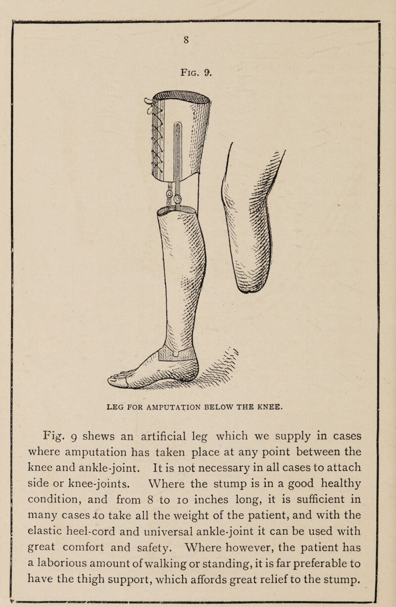 Fig. 9. LEG FOR AMPUTATION BELOW THE KNEE. Fig. 9 shews an artificial leg which we supply in cases where amputation has taken place at any point between the knee and ankle-joint. It is not necessary in all cases to attach side or knee-joints. Where the stump is in a good healthy condition, and from 8 to lo inches long, it is sufficient in many cases .to take all the weight of the patient, and with the elastic heel-cord and universal ankle-joint it can be used with great comfort and safety. Wdiere however, the patient has a laborious amount of walking or standing, it is far preferable to have the thigh support, which affords great relief to the stump.