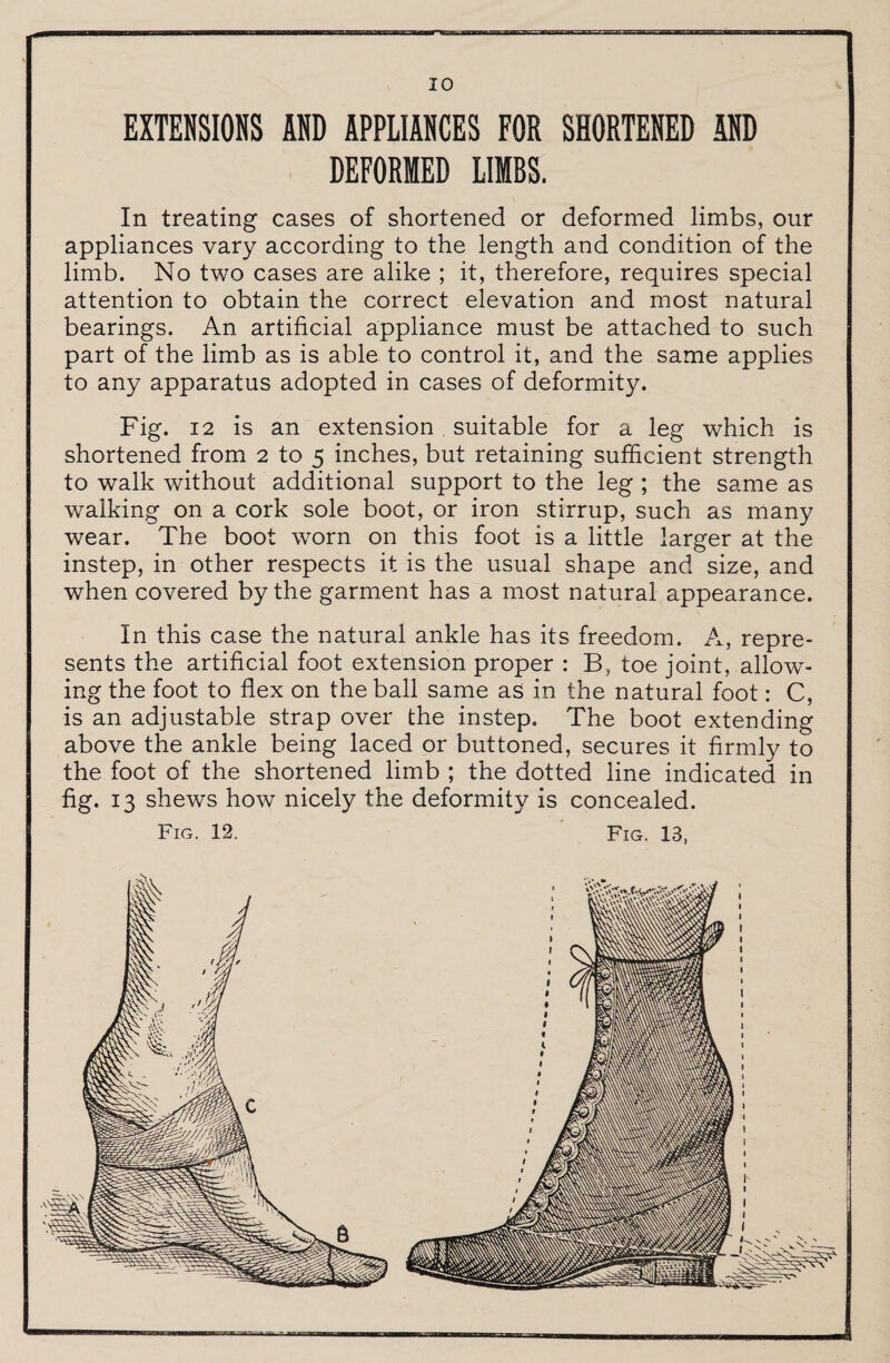 EXTENSIONS AND APPLIANCES FOR SHORTENED AND DEFORMED LIMBS. In treating cases of shortened or deformed limbs, our appliances vary according to the length and condition of the limb. No two cases are alike ; it, therefore, requires special attention to obtain the correct elevation and most natural bearings. An artificial appliance must be attached to such part of the limb as is able to control it, and the same applies to any apparatus adopted in cases of deformity. Fig. 12 is an extension, suitable for a leg which is shortened from 2 to 5 inches, but retaining sufficient strength to walk without additional support to the leg ; the same as walking on a cork sole boot, or iron stirrup, such as many wear. The boot worn on this foot is a little larger at the instep, in other respects it is the usual shape and size, and when covered by the garment has a most natural appearance. In this case the natural ankle has its freedom. A, repre¬ sents the artificial foot extension proper : B, toe joint, allow¬ ing the foot to flex on the ball same as in the natural foot: C, is an adjustable strap over the instep. The boot extending above the ankle being laced or buttoned, secures it firmly to the foot of the shortened limb ; the dotted line indicated in fig. 13 shews how nicely the deformity is concealed. Fig. 12. Fig. 13,
