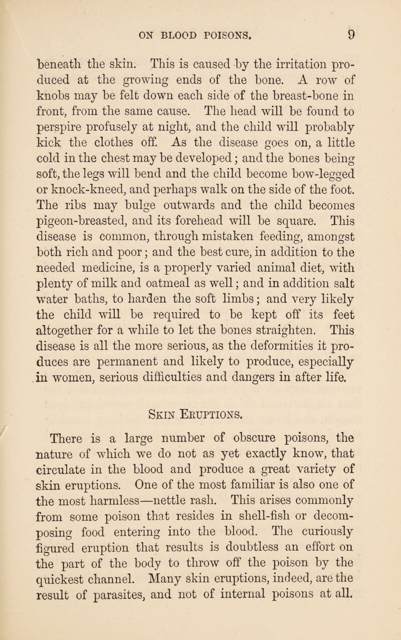 beneath the skin. This is caused by the irritation pro¬ duced at the growing ends of the bone. A row of knobs may be felt down each side of the breast-bone in front, from the same cause. The head will be found to perspire profusely at night, and the child will probably kick the clothes off. As the disease goes on, a little cold in the chest may be developed; and the bones being soft, the legs will bend and the child become bow-legged or knock-kneed, and perhaps walk on the side of the foot. The ribs may bulge outwards and the child becomes pigeon-breasted, and its forehead will be square. This disease is common, through mistaken feeding, amongst both rich and poor; and the best cure, in addition to the needed medicine, is a properly varied animal diet, with plenty of milk and oatmeal as well; and in addition salt water baths, to harden the soft limbs; and very likely the child will be required to be kept off its feet altogether for a while to let the bones straighten. This disease is all the more serious, as the deformities it pro¬ duces are permanent and likely to produce, especially in women, serious difficulties and dangers in after life. Skin Ekuptions. There is a large number of obscure poisons, the nature of which we do not as yet exactly know, that circulate in the blood and produce a great variety of skin eruptions. One of the most familiar is also one of the most harmless—nettle rash. This arises commonly from some poison that resides in shell-fish or decom¬ posing food entering into the blood. The curiously figured eruption that results is doubtless an effort on the part of the body to throw off the poison by the quickest channel. Many skin eruptions, indeed, are the result of parasites, and not of internal poisons at all.