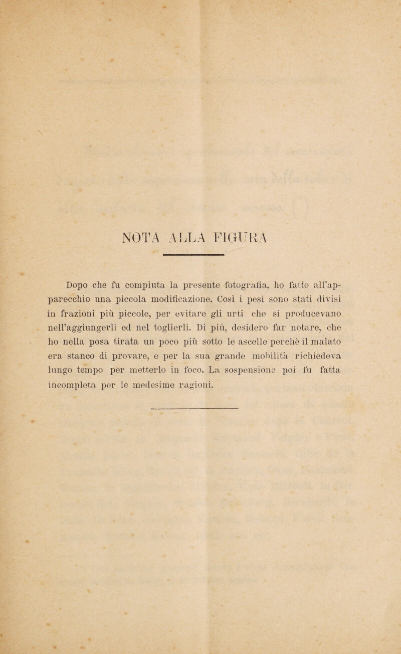 NOTA ALLA FIGURA Dopo che fu compiuta la presente fotografia, ho fatto all’ap¬ parecchio una piccola modificazione. Così i pesi sono stati divisi in frazioni più piccole, per evitare gli urti che si producevano neH’aggiungerli ed nel toglierli. Di più, desidero far notare, che ho nella posa tirata un poco più sotto le ascelle perchè il malato era stanco di provare, e per la sua grande mobilita richiedeva lungo tempo per metterlo in foco. La sospensione poi fu fatta incompleta per le medesime ragioni.