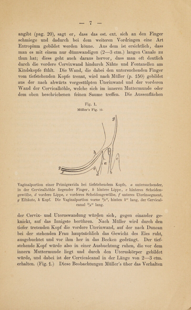 angibt (pag. 20), sagt er, class das ost. ext. sich an den Finger schmiege und dadurch bei dem weiteren Yordringen eine Art Entropium gebildet werden konne. Aus dem ist ersichtlich, dass man es mit einem nur dtinnwandigen (2—3 ctm.) langen Canale zu tbun bat; diess geht auch daraus hervor, dass man oft deutlich durch die vordere Cervixwand bindurcb Nahte und Fontanellen am Kindskopfe ftihlt. Die Wand, die dabei den untersuchenden Finger vom tiefstehenden Kopfe trennt, wird nach Muller (p. 150) gebildet aus der nacb abwarts vorgestiilpten Uterinwancl und der vorderen Wand der Cervicalhohle, welche sich im inneren Muttermunde oder dem oben beschriebenen feinen Saume treffen. Die Aussenflachen Fig. 1. Muller’s Fig. 15. Vaginalportion einer Primigravida bei tiefstehendem Kopfe. a untersuchender, in der Cervicalhohle liegender Finger, b hintere Lippe, c hinteres Scheiden- gewolbe, d vordere Lippe, e vorderes Scheidengewolbe, f unteres Uterinsegment, g Eihaute, li Kopf. Die Vaginalportion vorne W', hinten 1 lang, der Cervical- canal 5/4^ lang. der Cervix- und Uteruswandung wiirden sich, gegen einander ge- knickt, auf clas Innigste beriihren. Nach Muller wird durch den tiefer tretenclen Kopf die vordere Uterinwand, auf der nach Duncan bei der stehenden Frau hauptsachlich das Gewicht des Eies ruht, ausgebuchtet und vor ihm her in das Becken gedrangt. Der tief- stehende Kopf wtirde also in einer Ausbuchtung ruhen, die vor dem innern Muttermunde liegt und durch den Uteruskorper gebildet wtirde, und dabei ist der Cervicalcanal in der Lange von 2—3 ctm. erhalten. (Fig. 1.) Diese Beobachtungen Muller’s liber das Verhalten