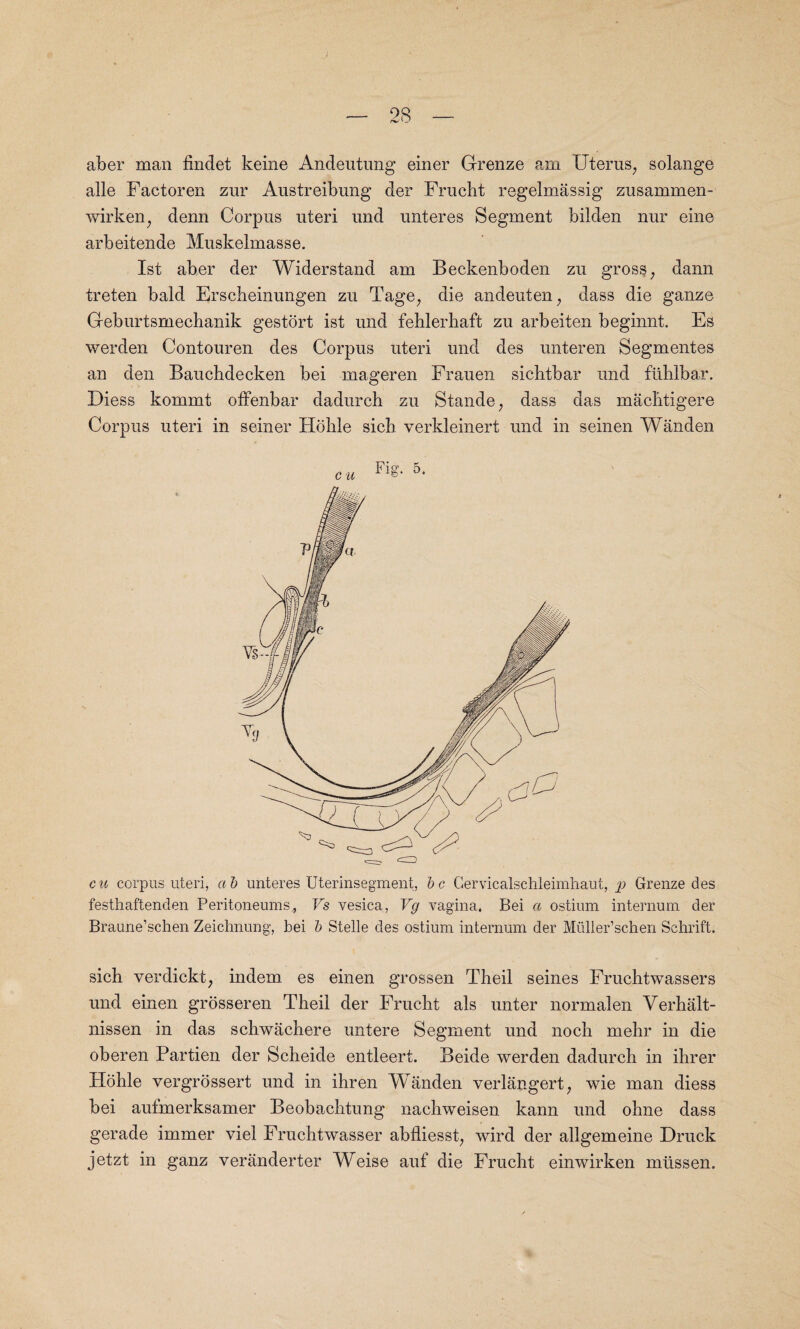 aber man findet keine Andeutung einer Grenze am Uterus, solange alle Factoren zur Austreibung der Frucbt regelmassig zusammen- wirken, denn Corpus uteri und unteres Segment bilden nur eine arbeitende Muskelmasse. 1st aber der Widerstand am Beckenboden zu gross, dann treten bald Erscheinungen zu Tage, die andeuten, dass die ganze Geburtsmechanik gestdrt ist und fehlerhaft zu arbeiten beginnt. Es werden Contouren des Corpus uteri und des unteren Segmentes an den Bauchdecken bei mageren Frauen sicbtbar und fuhlbar. Diess kommt offenbar dadurch zu Stande, dass das machtigere Corpus uteri in seiner Ho hie sich verkleinert und in seinen Wanden cu corpus uteri, ab unteres Uterinsegment, be Gervicalschleimhaut, p Grenze des festhaftenden Peritoneums, Vs vesica, Vg vagina. Bei a ostium internum der Braune’schen Zeiclmung, bei b Stelle des ostium internum der Mulier’schen Schrift. sich verdickt, indem es einen grossen Theil seines Fruchtwassers und einen grosseren Theil der Frucht als unter normalen Yerhalt- nissen in das schwachere untere Segment und noch mehr in die oberen Partien der Scheide entleert. Beide werden dadurch in ihrer Hohle vergrossert und in ihren Wanden verlangert, wie man diess bei aufmerksamer Beobachtung nachweisen kann und ohne dass gerade immer viel Fruchtwasser abfliesst, wird der allgemeine Druck jetzt in ganz veranderter Weise auf die Frucht einwirken mtissen.