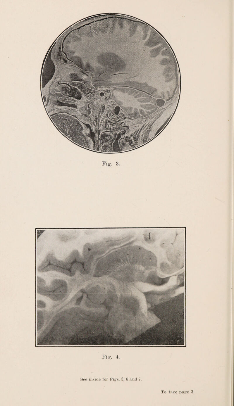 Fig. 4. Bee inside for Figs. 5, 6 and 7.