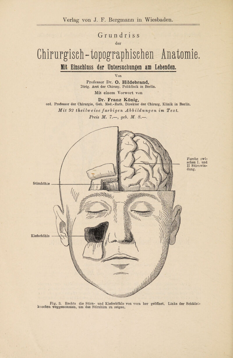 Grundriss der Chirurg’isch-topog’rapliiselien Anatomie. Mit Einscblnss der Untersuchungen am Lebenden. Yon Professor Dr. O. Hildebrand, Dirig. Arzt der Chirurg. Poliklinik in Berlin. Mit einem Vorwort von Dr. Franz König, ord. Professor der Chirurgie, Geh. Med.-Rath, Direktor der Chirurg. Klinik in Berlin. Mit 92 theilw eise farbigen Abb ildung en im Text. Preis M. 7.—, geb. M. 8.—. Stirnhöhle Kieferhöhle Furche zwi¬ schen I. und II Stirnwin¬ dung. Fig. 3. Rechts die Stirn- und Kieferhöhle von vorn her geöffnet. Links der Schädel* knochen weggenommen, um das Stirnhirn zu zeigen.