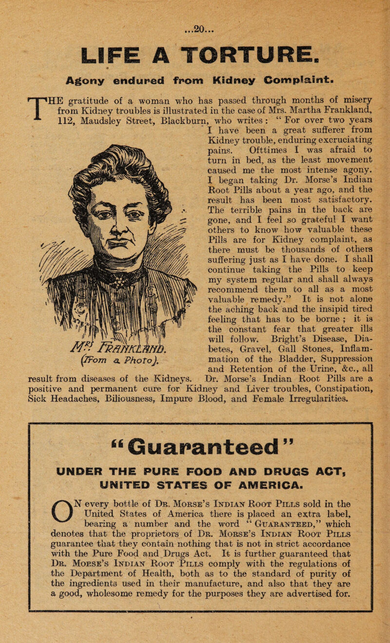 LIFE A TORTURE. Agony endured from Kidney Complaint. THE gratitude of a woman who has passed through months of misery from Kidney troubles is illustrated in the case of Mrs. Martha Frankland, 112, Maudsley Street, Blackburn, who writes : “ For over two years I have been a great sufferer from Kidney trouble, enduring excruciating pains. Ofttimes I was afraid to turn in bed, as the least movement caused me the most intense agony. I began taking Dr. Morse’s Indian Root Pills about a year ago, and the result has been most satisfactory. The terrible pains in the back are gone, and I feel so grateful I want others to knowr how valuable these Pills are for Kidney complaint, as there must be thousands of others suffering just as I have done. I shall continue taking the Pills to keep my system regular and shall always recommend them to all as a most valuable remedy.” It is not alone the aching back and the insipid tired feeling that has to be borne ; it is the constant fear that greater ills will follow. Bright’s Disease, Dia¬ betes, Gravel, Gall Stones, Inflam¬ mation of the Bladder, Suppression and Retention of the Urine, &c., all Dr. Morse’s Indian Root Pills are a positive and permanent cure for Kidney and Liver troubles, Constipation, Sick Headaches, Biliousness, Impure Blood, and Female Irregularities. “ Guaranteed ” UNDER THE PURE FOOD AND DRUGS ACTS UNITED STATES OF AMERICA. N every bottle of Dr. Morse’s Indian Root Pills sold in the United States of America there is placed an extra label, bearing a number and the word “ Guaranteed,” which denotes that the proprietors of Dr. Morse’s Indian Root Pills guarantee that they contain nothing that is not in strict accordance with the Pure Food and Drugs Act. It is further guaranteed that Dr, Morse’s Indian Root Pills comply with the regulations of the Department of Health, both as to the standard of purity of the ingredients used in their manufacture, and also that they are a good, wholesome remedy for the purposes they are advertised for. (irom <a Photo), result from diseases of the Kidneys.