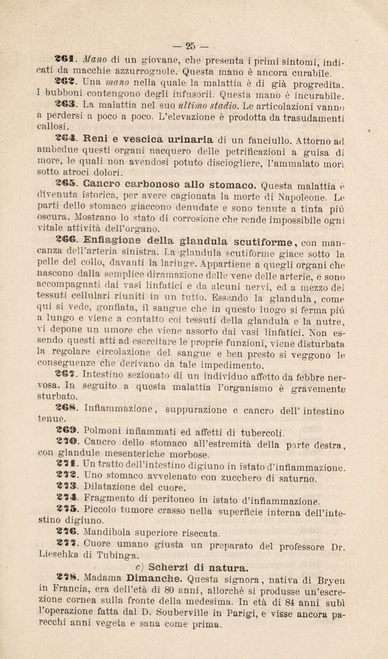 Mano di un giovane, che presenta i primi sintomi, indi¬ cati da macchie azzurrognole. Questa mano è ancora curabile. $**$• Una mano nella quale la malattia è di già progredita. I bubboni contengono degli infusorii. Questa mano è incurabile. La malattia nel suo ultimo stadio. Le articolazioni vanno a perdersi a poco a poco. L’elevazione è prodotta da trasudamenti, callosi. Reni e vescica urinaria di un fanciullo. Attorno ad ambedue questi organi nacquero delle petrifìcazioni a guisa di more, le quali non avendosi potuto disciogliere, l’ammalato morì sotto atroci dolori. ■Stó. Cancro earbonoso allo stomaco. Questa malattia è divenuta isterica, per avere cagionata la morte di Napoleone. Le pai ti dello stomaco giaccono denudate e sono tenute a tinta più oscura. Mostrano lo stato di corrosione che rende impossibile ogni vitale attività dell’organo. Enfiagione della gianduia scutiforme, con man¬ canza dell arteria sinistra. La gianduia scutiforme guaco sotto la pelle del collo, davanti la laringe. Appartiene a quegli organi che nascono dalla semplice diramazione delle vene delle arterie, e sono accompagnati dai vasi linfatici e da alcuni nervi, ed a mezzo dei tessuti cellulari riuniti in un tutto. Essendo la gianduia, come qui si vede, gonfiata, il sangue che in questo luog’o si ferma più a lungo e viene a contatto coi tessuti della gianduia e la nutre, vi depone un umore che viene assorto dai vasi linfatici. Non es¬ sendo questi a» ti ad esercitare le proprie funzioni, viene disturbata la regolale ciicolazione del sangme e ben presto si veggono le conseguenze che derivano da tale impedimento. Intestino sezionato di un individuo affetto da febbre ner¬ vosa. In seguito a questa malattia l’organismo è gTavemente sturbato. Infiammazione, suppurazione e cancro dell’ intestino tenue. Polmoni infiammati ed affetti di tubercoli. «90. Cancro dello stomaco all’estremità della parte destra, con gl an dui e mesenteriche morbose. «91. Un tratto dell’intestino digiuno in istato d’infiammazione. Uno stomaco avvelenato con zucchero di saturno. $93. Dilatazione del cuore. «91:. Fiagmento di peritoneo in istato d’infiammazione. «95. Piccolo tumore crasso nella superfìcie interna dell’inte¬ stino digiuno. «9©. Mandibola superiore risecata. X'%%. Cuore umano giusta un preparato del professore Dr. Liesehka di Tubinga. c) Scherzi di natura. «98. Madama Diman che. Questa signora, nativa di Bryen in trancia, era dell’età di 80 anni, allorché si produsse un’escre¬ zione cornea sulla fronte della medesima. In età di 84 anni subì 1 operazione fatta dal D. Souberville in Parigi, e visse ancora pa¬ recchi anni vegeta e sana come prima.