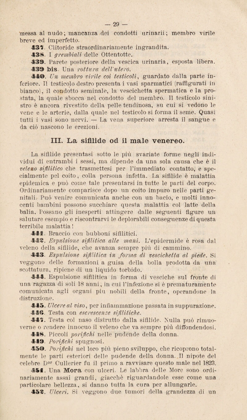 messa al nudo; mancanza dei condotti urinarii; membro virile breve ed imperfetto. 43^. Clitoride straordinariamente ingrandita. 438. I gremitali delle Ottentotte. 430. Parete posteriore della vescica urinaria, esposta libera. 430 bis. Una rottura dell'utero. 440. Un membro virile coi testicoli, guardato dalla parte in¬ feriore. TI testicolo destro presenta i vasi sparmatici (raffigurati in bianco), il condotto seminale, la vescichetta spermatica e la pro¬ stata, la quale sbocca nel condotto del membro. Il testicolo sini¬ stro è ancora rivestito della pelle tendinosa, su cui si vedono le vene e le arterie, dalla quale nel testicolo si forma il seme. Quasi tutti i vasi sono nervi. — La vena superiore arresta il sangue e da ciò nascono le erezioni. III. La sifìlide od il male venereo. La sifìlide presentasi sotto le più svariate forme negli indi¬ vidui di entrambi i sessi, ma dipende da una sola causa che è il veleno sifilitico che trasmettesi per l’immediato contatto, e spe¬ cialmente pel coito, colla persona infetta. La sifìlide è malattia epidemica e può come tale presentarsi in tutte le parti del corpo. Ordinariamente comparisce dopo un coito impuro nelle parti ge¬ nitali. Può venire comunicata anche con un bacio, e molti inno¬ centi bambini possono succhiare questa malattia col latte della balia. Possano gli inesperti attingere dalle seguenti figure un salutare esempio e riscontrarvi le deplorabili conseguenze di questa terribile malattia ! 441. Braccio con bubboni sifilitici. 44<£. Espulsione sifilitica alle mani. L’epidermide è rosa dal veleno della sifìlide, che avanza sempre più di cammino. 443. Espulsione sifilitica in forma di vescichetta al piede. Si veggono delle formazioni a guisa della bolla prodotta da una scottatura, ripiene di un liquido torbido. 444. Espulsione sifilitica in forma di vesciche sul fronte di una ragazza di soli 18 anni, in cui l’infezione si è prematuramente comunicata agli organi piu nobili della fronte, operandone la distruzione. 445. Ulcere al viso, per infiammazione passata in suppurazione. -III». Testa con escrescenze sifilitiche. 443. Testa col naso distrutto dalla sifilide. Nulla può rimuo¬ verne o rendere innocuo il veleno che va sempre più diffondendosi. 448. Piccoli porifichi nelle pudende della donna. 440. Porifichi spugnosi. 450. Porifichi nel loro più pieno sviluppo, che ricoprono total¬ mente le parti esteriori delle pudende della donna. Il nipote del celebre Dor Cullerier fu il primo a ravvisare questo male nel 1823. 4&fl. Una Mora con ulceri. Le labbra delle More sono ordi¬ nariamente assai grandi, giacché riguardandole esse come una particolare bellezza, si danno tutta la cura per allungarle. 45Z. Ulceri. Si veggono due tumori della grandezza di un