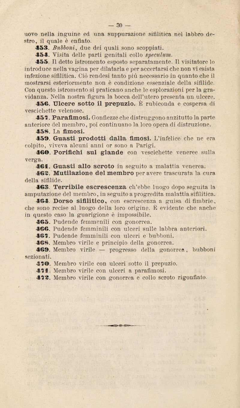 uovo nella inguine ed una suppurazione sifilitica nel labbro de¬ stro, il quale è enfiato. 453. Bubboni, due dei quali sono scoppiati. 454. Visita delle parti genitali collo speculum. 455. Il detto istromento esposto separatamente. Il visitatore lo introduce nella vagina per dilatarla e per accertarsi che non vi esista infezione sifilitica. Ciò rendesi tanto più necessario in quanto che il mostrarsi esteriormente non è condizione essenziale della sifìlide. Con questo istromento si praticano anche le esplorazioni per la gra¬ vidanza. Nella nostra figura la bocca dell’utero presenta un ulcere. 456. Ulcere sotto il prepuzio. È rubiconda e cospersa di vescichette velenose. 45^. Farafìmosi. Gonfiezze che distruggono anzitutto la parte anteriore del membro, poi continuano la loro opera di distruzione. 458. La fimosi. 45®. Guasti prodotti dalla fimosi. L’infelice che ne era colpito, viveva alcuni anni or sono a Parigi. 4GO. Porifìclii sul glande con vescichette veneree sulla verg'a. 461. Guasti allo scroto in seguito a malattia venerea. 46£. Mutilazione del membro per avere trascurata la cura della sifìlide. 463. Terribile escrescenza ch’ebbe luogo dopo seguita la amputazione del membro, in seguito a progredita malattia sifilitica. 4M. Dorso sifilitico, con escrescenza a guisa di fìmbrie, che sono recise al luogo della loro origine. È evidente che anche in questo caso la guarigione è impossibile. 465. Pudende femminili con gonorrea. 466. Pudende femminili con ulceri sulle labbra anteriori. 463. Pudende femminili con ulceri e bubboni. 468. Membro virile e principio della gonorrea. 46®. Membro virile — progresso della gonorrea, bubboni sezionati. 41(0. Membro virile con ulceri sotto il prepuzio. 49't. Membro virile con ulceri a parafìmosi. Membro virile con gonorrea e collo scroto rigonfiato.