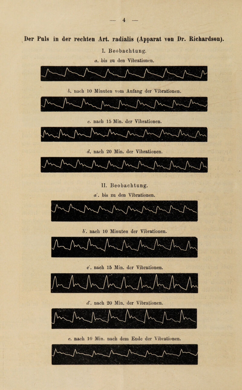 Der Puls in der rechten Art. radialis (Apparat von Dr. Richardson). I. Beobachtung. a. bis zu den Vibrationen. b. nach 10 Minuten vom Anfang der Vibrationen. c. nach 15 Min. der Vibrationen. d. nach 20 Min. der Vibrationen. d'. nach 20 Min. der Vibrationen. e. nach 10 Min. nach dem Ende der Vibrationen. II. Beobachtung. a'. bis zu den Vibrationen. b'. nach 10 Minuten der Vibrationen.