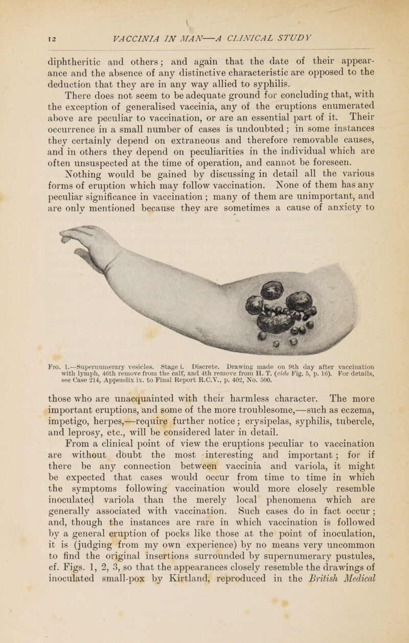 diphtheritic and others; and again that the date of their appear¬ ance and the absence of any distinctive characteristic are opposed to the deduction that they are in any way allied to syphilis. There does not seem to be adequate ground for concluding that, with the exception of generalised vaccinia, any of the eruptions enumerated above are peculiar to vaccination, or are an essential part of it. Their occurrence in a small number of cases is undoubted; in some instances they certainly depend on extraneous and therefore removable causes, and in others they depend on peculiarities in the individual which are often unsuspected at the time of operation, and cannot be foreseen. Nothing would be gained by discussing in detail all the various forms of eruption which may follow vaccination. None of them has any peculiar significance in vaccination; many of them are unimportant, and are only mentioned because they are sometimes a cause of anxiety to Fig. 1.—Supernumerary vesicles. Stage i. Discrete. Drawing made on 9th day after vaccination with lymph, 46th remove from the calf, and 4th remove from H. T. (vide Fig. 5, p. 16). For details, see Case 214, Appendix ix. to Final Report R.C.V., p. 402, No. 500. those who are unacquainted with their harmless character. The more important eruptions, and some of the more troublesome,—such as eczema, impetigo, herpes,—require further notice; erysipelas, syphilis, tubercle, and leprosy, etc., will be considered later in detail. From a clinical point of view the eruptions peculiar to vaccination are without doubt the most interesting and important; for if there be any connection between vaccinia and variola, it might be expected that cases would occur from time to time in which the symptoms following vaccination would more closely resemble inoculated variola than the merely local phenomena which are generally associated with vaccination. Such cases do in fact occur; and, though the instances are rare in which vaccination is followed by a general eruption of pocks like those at the point of inoculation, it is (judging from my own experience) by no means very uncommon to find the original insertions surrounded by supernumerary pustules, cf. Figs. 1, 2, 3, so that the appearances closely resemble the drawings of inoculated small-pox by Kirtland, reproduced in the British Medical