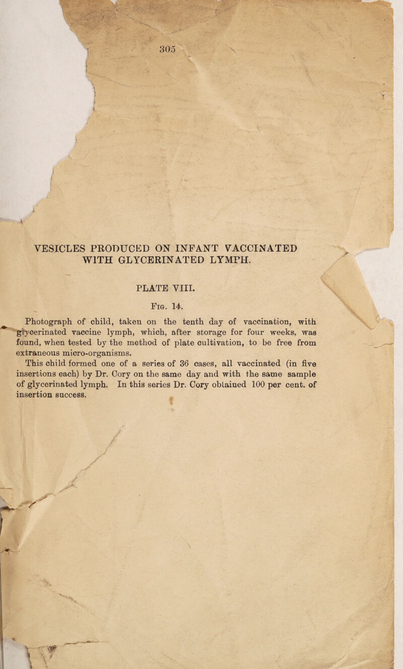 \ VESICLES PRODUCED ON INFANT VACCINATED WITH GLYCERINATED LYrMFH. PLATE VIII. Fig. 14. Photograph of child, taken on the tenth day of vaccination, with glycerinated vaccine lymph, which, after storage for four weeks, was found, when tested by the method of plate cultivation, to be free from extraneous micro-organisms. This child formed one of a series of 36 cases, all vaccinated (in five insertions each) by Dr. Cory on the same day and with the same sample of glycerinated lymph. In this series Dr. Cory obtained 100 per cent, of insertion success. * v 1