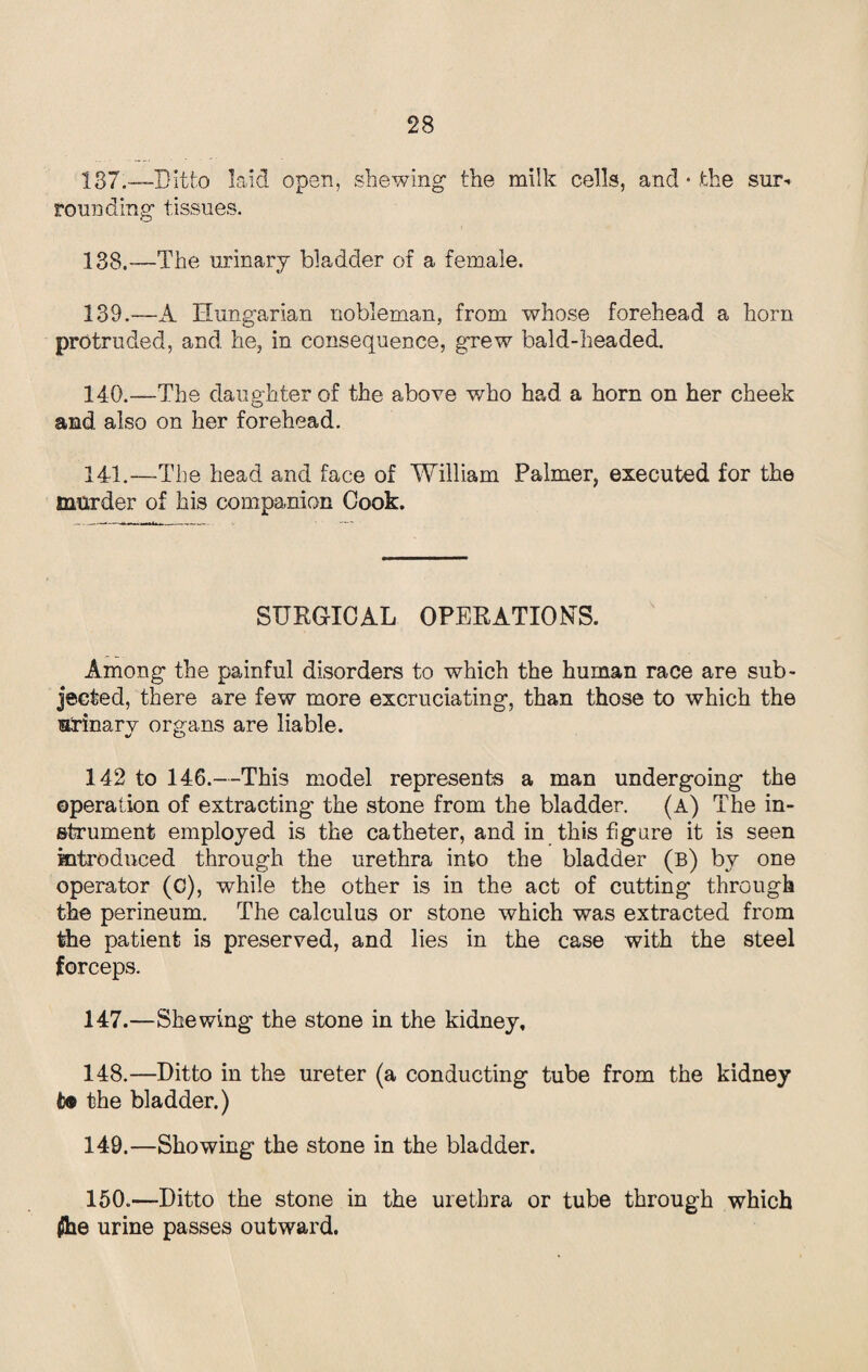137.—Ditto laid open, shewing the milk cells, and • fche sur* rounding tissues. 133,—The urinary bladder of a female. 139. —A Hungarian nobleman, from whose forehead a horn protruded, and he, in consequence, grew bald-headed. 140. —The daughter of the above who had a horn on her cheek and also on her forehead. 141. —The head and face of William Palmer, executed for the murder of his companion Cook. SURGICAL OPERATIONS. Among the painful disorders to which the human race are sub¬ jected, there are few more excruciating, than those to which the urinary organs are liable. 142 to 146.—This model represents a man undergoing the operation of extracting' the stone from the bladder. (a) The in¬ strument employed is the catheter, and in this figure it is seen introduced through the urethra into the bladder (b) by one operator (C), while the other is in the act of cutting through the perineum. The calculus or stone which was extracted from the patient is preserved, and lies in the case with the steel forceps. 147. —Shewing the stone in the kidney, 148. —Ditto in the ureter (a conducting tube from the kidney the bladder.) 149. —Showing the stone in the bladder. 150. —Ditto the stone in the urethra or tube through which |5he urine passes outward.