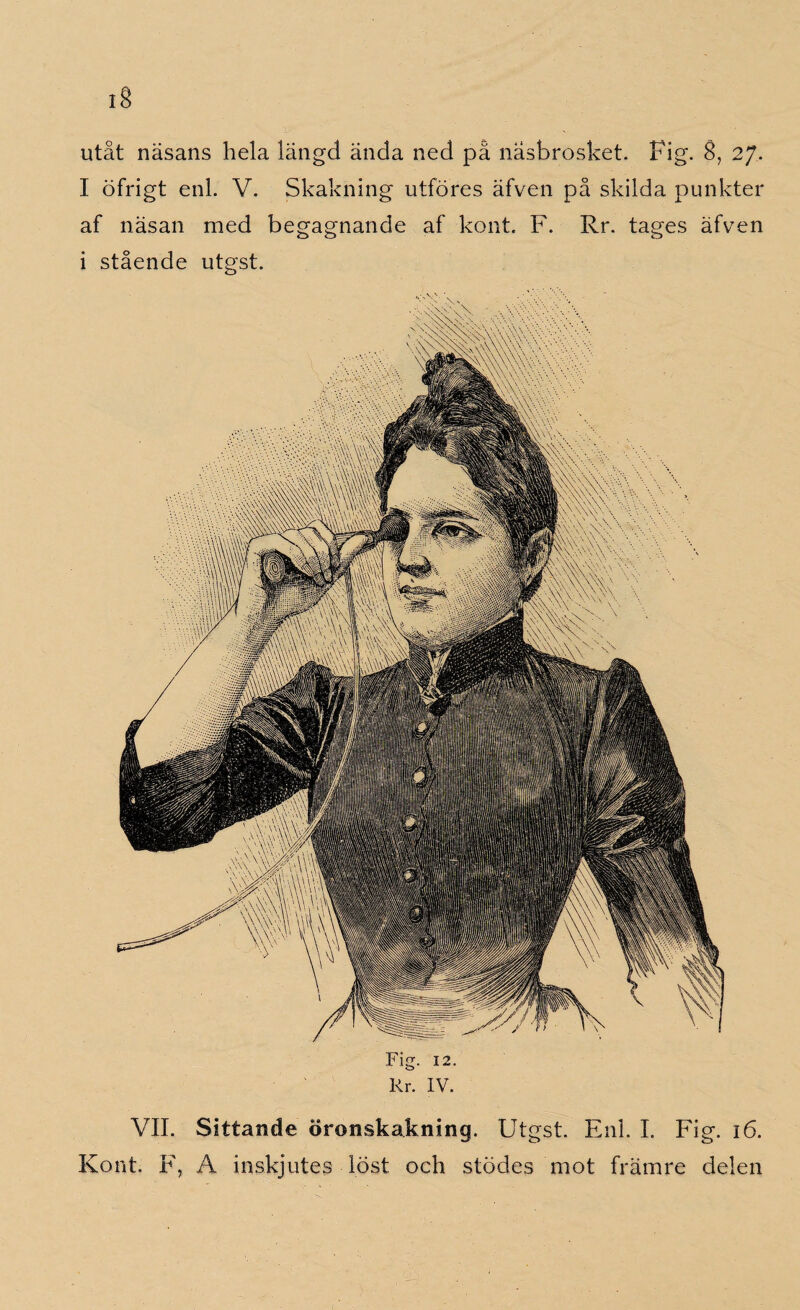 utåt näsans hela längd ända ned pä näsbrosket. Fig. 8, 27. I öfrigt enl. V. Skakning utföres äfven på skilda punkter af näsan med begagnande af kont. F. Rr. tages äfven i stående utgst. Fig. 12. Rr. IV. VII. Sittande öronskakning. Utgst. Enl. I. Fig. 16. Kont. F, A inskjutes löst och stödes mot främre delen