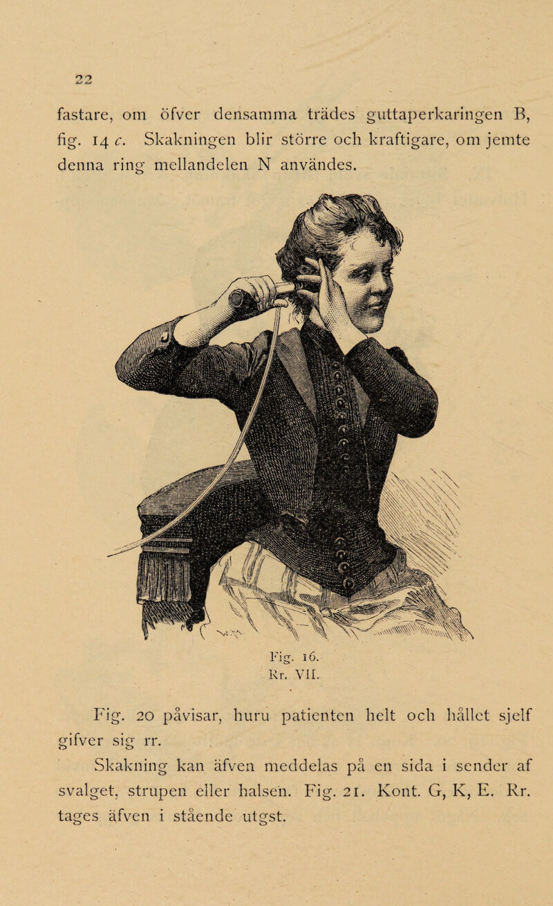 fastare, om öfver densamma trades guttaperkaringen B, tig. 14 c. Skakningen blir större och kraftigare, om jemte denna ring mcllandelen N användes. Fig. 16. Rr. VII. Fig. 20 påvisar, huru patienten helt och hållet sjelf gifver sig rr. Skakning kan äfven meddelas på en sida i sender af svalget, strupen eller halsen. Fig. 21. Kont. G, K, E. Rr. tages äfven i stående utgst.