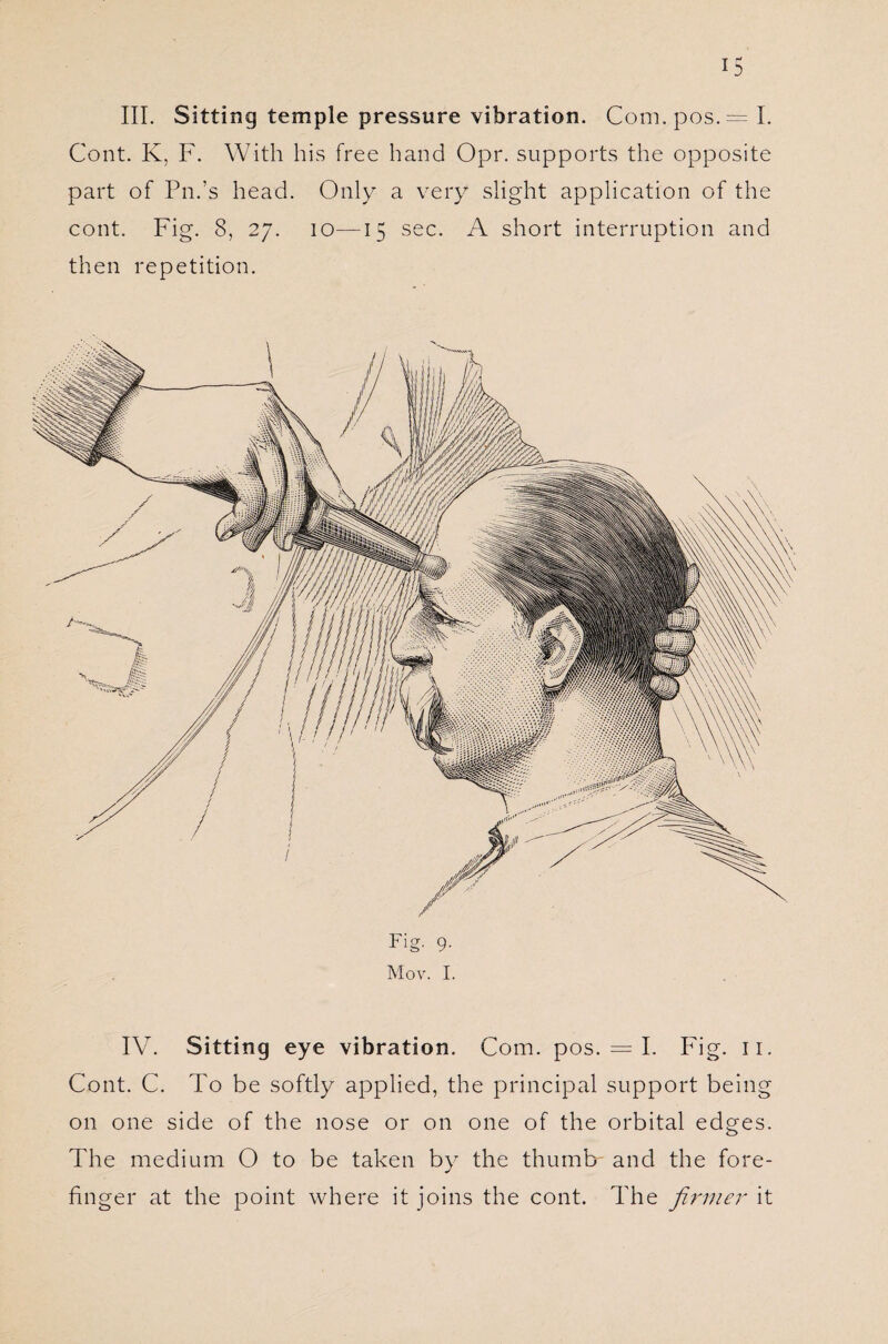 III. Sitting temple pressure vibration. Com.pos.= I. Cont. K, F. With his free hand Opr. supports the opposite part of Pn.’s head. Only a very slight application of the cont. Fig. 8, 27. 10—15 sec. A short interruption and then repetition. Fig. 9. Mov. I. IV. Sitting eye vibration. Com. pos. = I. Fig. 11. Cont. C. To be softly applied, the principal support being on one side of the nose or on one of the orbital edges. The medium O to be taken by the thumb- and the fore¬ finger at the point where it joins the cont. The firmer it