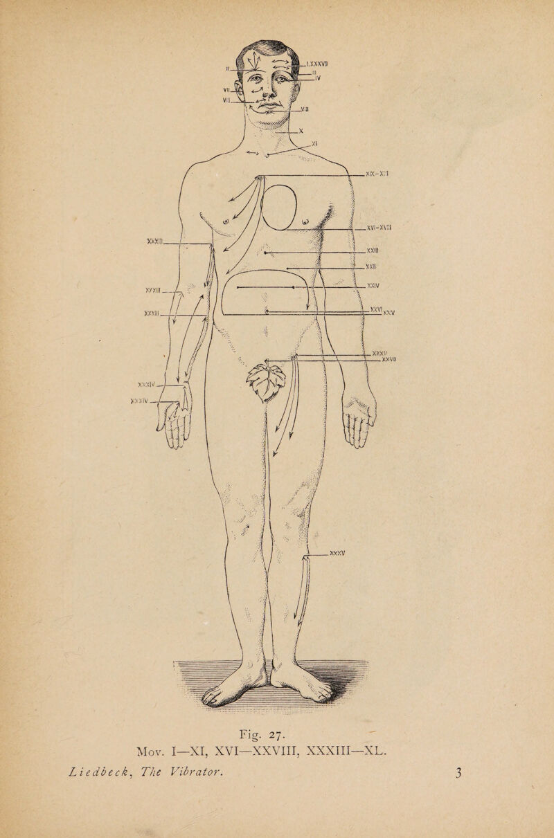 Mov. I—XI, XVI—XXVIII, XXXIII—XL. Liedbeck, The Vibrator. 3