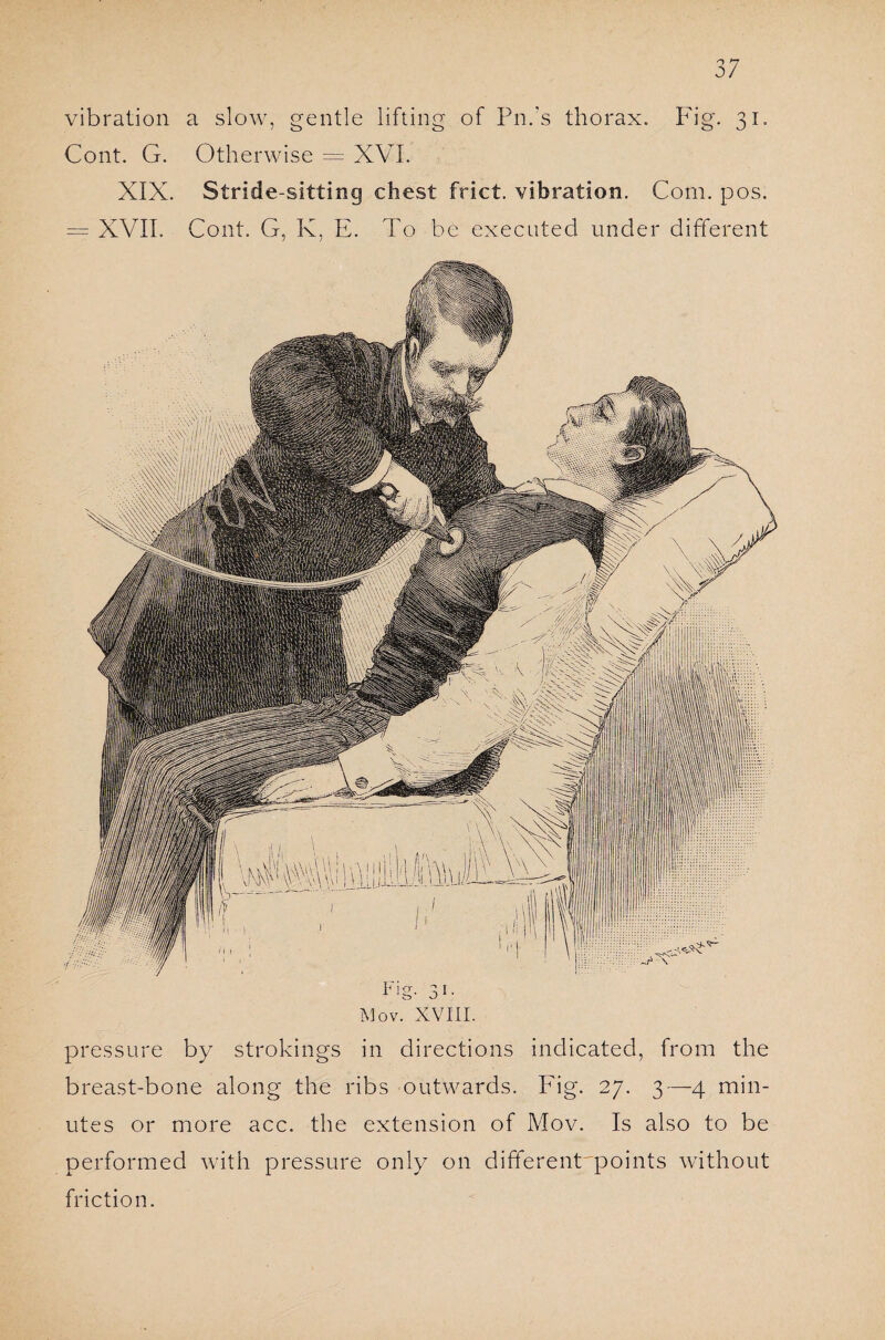 Cont. G. Otherwise = XVI. XIX. Stride-sitting chest frict. vibration. Com. pos. = XVII. Cont. G, K, E. To be executed under different Mov. XVIII. pressure by strokings in directions indicated, from the breast-bone along the ribs outwards. Fig. 27. 3—4 min¬ utes or more acc. the extension of Mov. Is also to be performed with pressure only on different'points without friction.