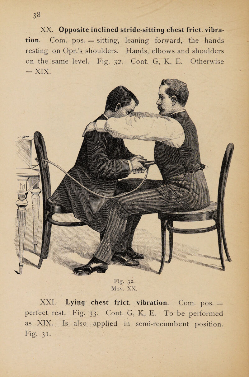 XX. Opposite inclined stride-sitting chest frict. vibra¬ tion. Com. pos. = sitting, leaning forward, the hands resting on Opr.’s shoulders. Hands, elbows and shoulders on the same level. Fig. 32. Cont. G, K, E. Otherwise = XIX. Fig. 32. Mov. XX. XXI. Lying chest frict. vibration. Com. pos. — perfect rest. Fig. 33. Cont. G, K, E. To be performed as XIX. Is also applied in semi-recumbent position. Fig. 31.