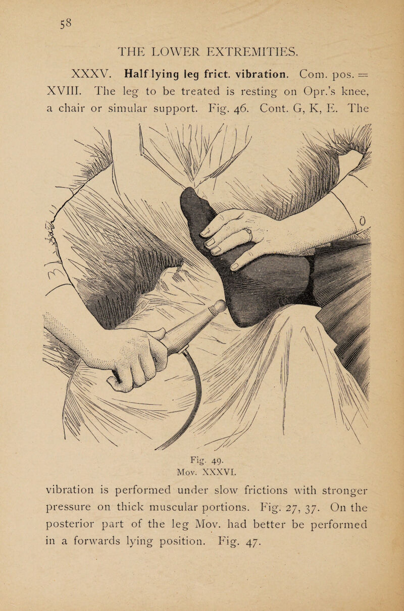 THE LOWER EXTREMITIES. XXXV. Half lying leg frict. vibration. Com. pos. = XVIII. The leg' to be treated is resting on Opr.’s knee, a chair or simular support. Fig. 46. Cont. G, K, E. The Fig. 49. Mov. XXXVI. vibration is performed under slow frictions with stronger pressure on thick muscular portions. Fig. 27, 37. On the posterior part of the leg Mov. had better be performed in a forwards lying position. Fig. 47.