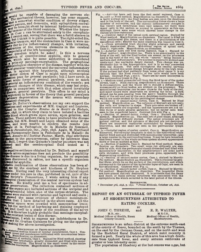 *6, 1899-] TYPHOID FEVER AND COCKLES. [Ts* Barrow Mameti. /otjiwti I669 Id be capable of damaging the nervous ele- mechanical theory, however, has some support, . a s0mewhat similar condition of drowsy stupor, paresis, and dementia, with epileptiform convul- ' ,lVt?be brought about by internal hydrocephalus occa- Lutnour of the third ventricle. Whether the hyper- Oise 1 can be attributed solely to the encephalo- r cannot say, seeing that there was a foetid abscess in but I think it is quite possible. The right-sided fits, ** .ar tremors, and the contracture in Case 11 were un- duetot‘ie inflammatory changes, with irritation, faction of the nervous elements in the cerebral Specially of the left hemisphere. ?r question might be asked : Is this a nervous ition of constitutional syphilis, akin to general which also by some authorities is considered 'primary meningo-encephalitis. The geographical ieuiiological character of the disease, together with the tof granular ventricles and the universal inflammatory 1 is against this hypothesis, although sections motor cortex of Case 11 might upon microscopical ition pass for general paralysis; but I have never, in it acute forms of general paralysis, seen so much ,general an inflammatory condition of the vessels; yet ^cell changes of this disease, which may last years, rht in comparison with that other almost invariably L»ase. general paralysis. This offers to my mind a kgyguoieat in favour of the theory that general paralysis Rrimary degeneration of the neuron with secondary ii&tory changes. ier Dr. Bulloch’s observations nor my own support the flona and experiments of MM. Gagigal and Lepierre, in the Comptes Rendus de la Societe de Biologic, r, 1898. in which they claim to have isolated a bacillus iblood which grows upon serum, upon gelatine, and Hon. These authors claim to have produced the disease ils, but MM. Brault and Lapin obtained some of the and were unable to confirm the results (sur » et la Pathog^nie de la Maladie du Sommeil, de tarasitologie, etc., July, 1898. Again. M.Marchand >dn Pneumocoque dans la Pathologie de la Maladie du iii, Annal°s de l' Institut Pasteur, March, 1899) attributes je to the pneumococcus, rather by inference than ... Still, I regret that, Quincke’s lumbar puncture was not and the cerebro-spinal fluid tested as I (negative evidence obtained by Dr. Bulloch and myself Is micro-organisms does not preclude the possibility disease is due to a living organism, for no organism fn discovered in rabies, nor has a specific organism tfwmd for syphilis. ‘>le confirmation of these observations has been a£- si me by^ the courtesy and kindness of Dr. Stephen “lie. Having read the very interesting clinical report under his care in 1890, published in vol. xxiv of the Society’s Transactions, I wrote asking him if any >pical examination of the central nervous system had [Baade, He kindly sent me a box of specimens in ad- , Preservation. The collection contained sections of ^the organs ana included sections of the occipital and ““L sphenoidal lobes, also of the corpus striatum. The is were stained with carmine and logwood and eosin ; k£f.0Wed the same evidence of chronic meningo-en- *8 that I have detailed in the above cases. All the ® ar spaces were crowded with mononuclear leuco- oot the method of hardening and staining employed V It * ^ *^elf to a study of the condition of the nerve ktu 18 khere'ore highly probable that meningo-encephal- l<awlCOri8^aDt lesi°n °f this disease. J®**eia8ioa, I wish to express my indebtedness to Dr. «l i?1!?- ^r* Grattan Guinness for giving me the opportu¬ nhiking the above investigation. • Descrtvtion of Photo-micrographs. jfrmt&i of101* median fissure of lumbar enlargement, Case r. Con- tyfaT esgel and membranes infiltrated with mononuclear leuco- a?rnfication r5o diameters. medulla, Case 1. Stained by Nissl method, showing iyn» 1 uiia, l. ouaineu uy rNisai iiieuiou, su 1 a lymphatics, greatly distended and filled with mono- . wicoeytes. The blood in the small vessel in the centre e leucocytes. Magnification 250 diameters. Fig. Anterior horn cell from the first sacral segment, Case 11. St-ined ny Nissl method. Magnification 600 diameters. This shows a fairly normal cell; the Nissl bodies are seen upon the dendrons and in the body of the cell. The surrounding tissue shows a large number of leucocytes, and the chronic inflammatory changes in the vessels and membranes were very intense, yet there were many cells in the section as normal in appearance as this one, although there were some which showed some change in the chromopliilous substance. Fig. 4.—Central canal of the spinal cord, cervical region. Stained by Nissl method. Magnification 100 diameters. The canal is filled up with proliferated glia tissue, and there is a proliferation of the ependymal cells ; exactly the same condition was found in Case 11. Fig. 5.—Cross pyramidal tract showing slight sclerosis and recent (black) degenerated fibres. Mid-dorsal region of spinal cord, Case 11; right side. Magnification 200 diameters. Fig. 6.—Anterior horn cell first sacral segment. Case 1. Stained by Nissl method : magnification 600. There is no abnormality in the form of the cell, but the Nissl bodies are absent on the processes and in the Oody of the ceil, the whole “neuron” being stained a uniform dull diffuse purple. The nucleus is especial lv distinct and unstamed ; the nucleolus deeply stained. This change was un¬ doubtedly due to the hyperpyrexia, and 13 in no way connected with the disease. The cells throughout the central nervous system showed this acute change brought about by the high fever. If the patient had died suddenly from some other cause it is my opinion that the Nissl reaction of the cells would have been normal. Contrast Figs. 3 and 6. There are far more leucocytes in the surrounding tissue in Fig. 3. Fig. 7.—-Medium sized pyramidal cell from the third layer of the motor cortex, Case 1. Nissl staining, magnification 750 diameters. There is chromatolysis, and the whole cell is stained a diffuse purple, consequently no Nissl bodies are evident on the processes. Two mononuclear leucocytes can be seen close to the body of the cell, and many others were observable on altering the focus. A dark strand can be seen passing from the apical dendrou through the body of the cell and out by the axon, doubtless continuous fibrilloe, wnich are made evident by the pathological change. Fig. 8.—Section r>f sensori-motor cortex, Case 11. Stained by Nissl method. Magnification 200. The columns of Meynert are not seen; the cells are^ irregular in shape. Their processes are broken off; the small vessels are congested ; and the appearances are not un¬ like those of acute general paralysis; but no spider cells were seen in the superficial layers. Contrast this with Fig. 9. Fig. 9.—Section of sensori motor cortex, Case 1. Stained by Nissl method. Magnification 200. The cells are of good shape, although imperfectly and diffusely stained. The apical processes are of normal outline, and the columns of Meynert are not destroyed. There are numerous capillaries surrounded by deeply-stained leucocytes, and the same are seen in the perivascular lymph spaces. Fig. ro.—Occipital region of cortex, cerebri, Case 11. Magnification 150 diameters. Perivascular lymphatic is seen in the subcortical white matter filled and and distended with mononuclear leucocytes ; also a large number in the surrounding tissue. It may be here remarked that every vessel in the whole nervous system showed appearances more or less as marked as this. Fig. n.—Section of medulla, Case 11. Stained by Nissl method. Magni¬ fication 250 diameters. Two small veins cut obliquely are seen side by side, with the perivascular sheath distended and filled with mononuclear leucocytes ; in the neighbourhoo i are some nerve cells shrunken, and with their processes gone, apparently in a degenerating condition. Fig. 12.—Section of sensori-motor cortex, Case 1, stained by Marchi- Pal method. Magnification 200 diameters. The horizontal tangen¬ tial fibres which lie on the surface of the convolutions, and which correspond to the axons of the molecular layer of Cajal, are seen in fair abundance. Contrast with Fig. 13. Fig. 13.—Section of sensori-motor cortex, Case II. Stained by Marchi- Pal method. Magnification 200 diameters. The tangential fibres are here almost entirely destroyed. Tt is probable that the decay and death of these cortical structures was associated with the epileptiform fits which occurred in the later period of the illness. References. 1 December 3rd, 1898, p. 1672. 2 Presse Midicale, October 1st, 1898. REPORT ON AN OUTBREAK OF TYPHOID FEYER AT SHOEBURYNESS ATTRIBUTED TO EATING COCKLES. JOHN C. THRESH, M.D., etc , Medical Officer of Health, Essex County Council. BY and E. R. WALTER, M.R.C.S., Medical Officer of Health, Shoeburyness. Shoeburyness is an urban district at the extreme south-east of the county of Essex, bounded on the south by the Thames, on the east by the German Ocean, and on the north and west by the Roehford Rural District, of whieh until recently it formed a part. Nearly the whole of this area has a high death- rate from typhoid fever, and every autumn outbreaks of greater or less intensity occur. The population of Shoebury at the last census was 2,990, but