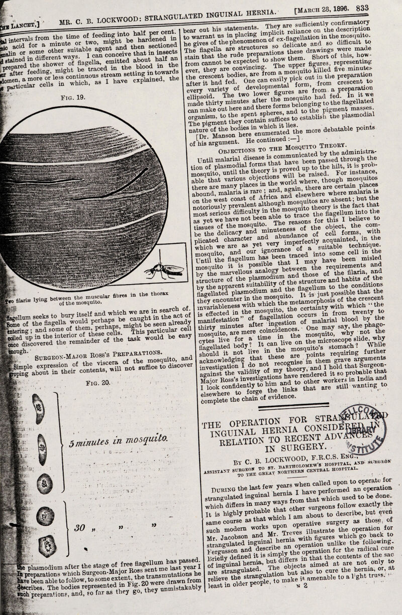 [March B LOCKWOOD: STRANGULATED INGUINAL HERN — _._  ! _ the ‘‘-““tlhfbetXedt £ acid lor a minutemnt and then sectioned “jin or some other smtahle agent an^ ^ in insects J stained in different ways. emitted about half an ‘‘pared the shower of flagella^imtt^ ^ ^ * after_ ?!fln„gr’lL continuous stream setting in towards » a£ter morem* less^continuous^stream setting in towards Ocular cells in which, as I have explained, Fig. 19 41ariie lying between the muscular fibres in the thorax Ulan® ^ q{ the moSquito. ellum seeks to bury itseU and wMch we“®t“ act of aSssrsisrt fff- ** - “fah^rtheif events, will not suffice to discover , Tupv are sufficiently confirmatory bear out his statements. reliance on the description to warrant us in placing P x.gaKenation in the mosquito. he gives of the phenomenon of e^flag^ ^ ^ auBcnlli * The flagella are structures ,1 ~ drawings were made stain that the ^ S. Shortof this, how- from cannot be expec - upper figures, representing ever, they are convincing. The^upper^ g ^ fiye .minute* the crescent bodies, are fro A out in the preparation after it had fed. One can ea y P from crescent to every variety of developm are from a preparation ellipsoid. The two lower fi|™e it0 had fed In it we fflSS-SSVS»1. rfSU ““““ “p nature of the bodies ^^^Vd the more debatable points fDr. Manson here enumeratea lu of U argument. He continued^-^ Objections to the Mo Q tbe administra- Until malarial dijewe ta .commnniicaU b tion of plasmodial forms thatt0\be hilt, it is prob- mosquito, until the ^will be raised. Eor instance, able that various Ejections where? tbough mosquitos there are many places in t . there are certain places abound, malana. is rare , a , g el;ewhere where malaria is on the west coast of Afric moermitos are absent; but tbe notoriously Pr,e.Tale^,a|‘hthl mosquito theory is the fact that most serious di&culty m t 4 tbe flagellum into the as°yet we have not been able to trace t ^ y b lieTe t0 tissues of the mosquito. The re object, the com- be the delicacy and Tmant^m of cell forms, with plicated character arid a fectty acquainted, m the which we are as yet y Pof a suitable technique, mosquito, and our ig traced into some cell in the Until the flagellum bee t w may have been misled mosquito it is Posslbw_ between the requirements and bv the marvellous analogy those of the filaria, and structure of the P^od^ t^eds*nctare and habits of the by the apparent suitabili y flanreiium to the conditions flagellated plasmodium . . ^ possible that tbe afy encounter in the mosquito^ U is jusr p crescent rnv^bleness with whrch the metemo^hos ^ is effected in the mosqmto, the cermi y twenty to manifestation ” of flaf “fstion of malarial blood by the thirty minutes atter '”?, . 0ne may say, the pbago- mosquito, are mere ?°“01fancfb; mosquito, why • not the cytes live for a tun on tbe microscopei slide,why flagellated body i lt.ca , mosauito’s stomach? While should it not live m th 1 ints requiring further acknowledging that these a _p them ?r!ive arguments investigation I do not rec g*1 d j bold that Surgeon- against the validity of my it so probable that Major Ross’s investigation other workers in India and hZ UnkT that”are still wanting to evidence. 5 minutes in mosquito. r \ \'t ■ i n -* d ' «AUSmAEco|Tsm| v t opkWOOD, f.r.c.s. En<??T by C. B. L0C^30T0];EW'8 hospital. Asm »«“> ASSISTANT SUEOKO TO^ST. CESTEAL HOSPITAL. smodium after the sta^e,?£1‘Eegossgsent me'last year I arations which Surgeon-Maj transmutations he ■en able to follow, to some exent, fte tram flrawn {rom es. The bodies represented rn T-ig. 20 w takably eparations, and, so far as they go, tney J. v A *-*■■*-•- - . . * ’ ,i , . . w vears when called upon to operate for Downs the last f T bave performed an operation strangulated inBulaa from that which used to be: done. which differs in many way surgeon3 follow exactly the It is highly x am about to describe, but even same course as t operative surgery as those, of such modem works^upon op the operat,0u for Mr. Jacobson and Mr. figures which go back to strangulated inguinal hernia w ® ike tbe following- Fergusson and describe, an for the radical cure Briefly defined it irfthat the contents of tne sac- of fn^uinal hernia, aimed at are not only to are strangulated. but ais0 to cure the hernia, or, at relieve th! strangulatmn but t0 a i=ght trues. least in older people, to maim g