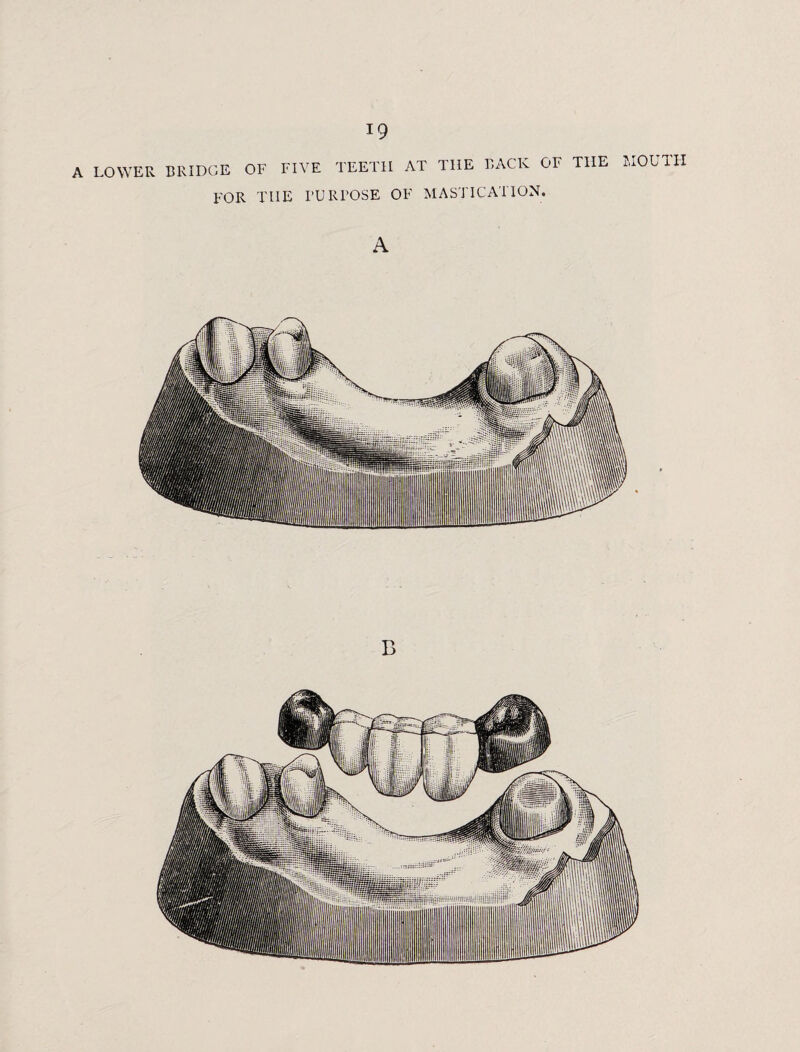 A LOWER BRIDGE OF FIVE TEETH AT THE BACK OF THE FOR THE I’URPOSE OF MASTICATION. MOUTH A B