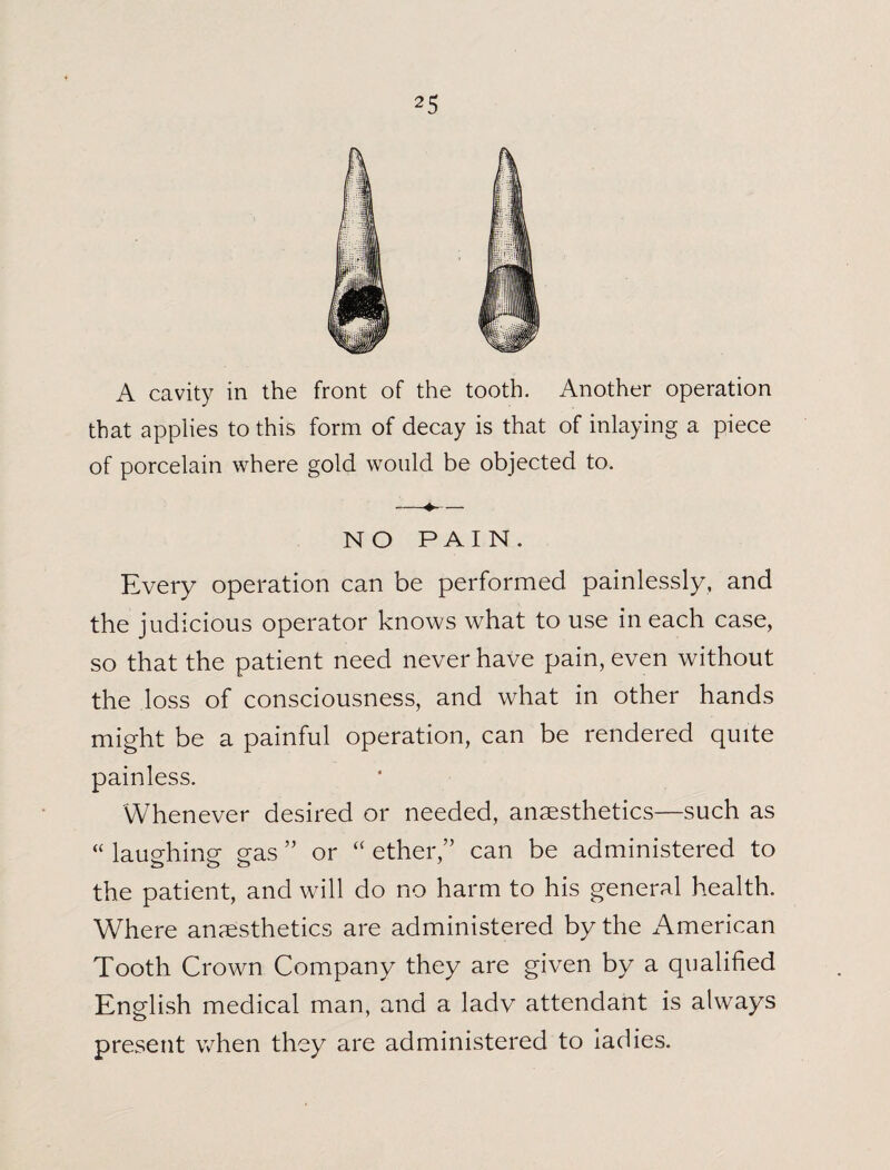 A cavity in the front of the tooth. Another operation that applies to this form of decay is that of inlaying a piece of porcelain where gold would be objected to. NO PAIN. Every operation can be performed painlessly, and the judicious operator knows what to use in each case, so that the patient need never have pain, even without the loss of consciousness, and what in other hands might be a painful operation, can be rendered quite painless. Whenever desired or needed, anaesthetics—such as “ laughing gas ” or “ ether,” can be administered to the patient, and will do no harm to his general health. Where anaesthetics are administered by the American Tooth Crown Company they are given by a qualified English medical man, and a ladv attendant is always present when they are administered to iadies.