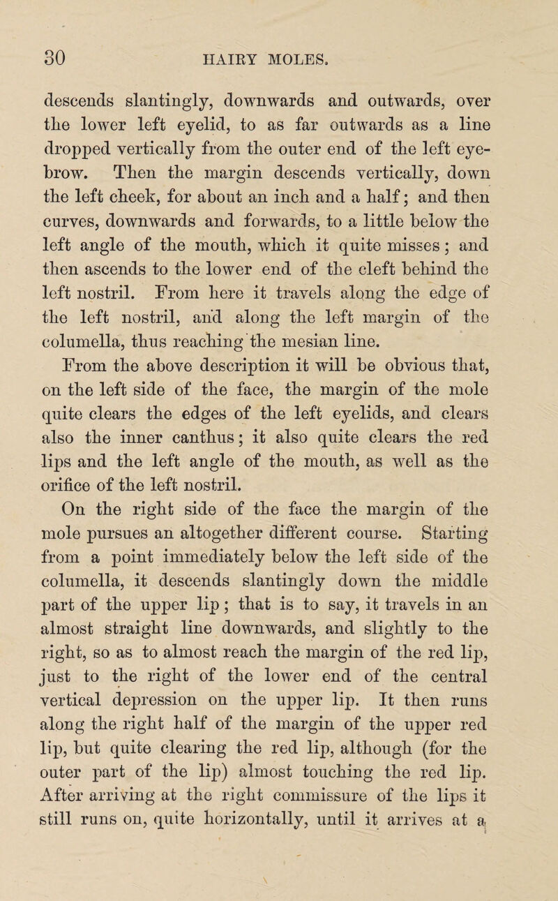 descends slantingly, downwards and outwards, over tlie lower left eyelid, to as far outwards as a line dropped vertically from the outer end of the left eye¬ brow. Then the margin descends vertically, down the left cheek, for about an inch and a half; and then curves, downwards and forwards, to a little below the left angle of the mouth, which it quite misses; and then ascends to the lower end of the cleft behind the left nostril. From here it travels alQng the edge of the left nostril, and along the left margin of the columella, thus reaching the mesian line. From the above description it will be obvious that, on the left side of the face, the margin of the mole quite clears the edges of the left eyelids, and clears also the inner canthus; it also quite clears the red lips and the left angle of the mouth, as well as the orifice of the left nostril. On the right side of the face the margin of the mole pursues an altogether different course. Starting from a point immediately below the left side of the columella, it descends slantingly down the middle part of the upper lip; that is to say, it travels in an almost straight line downwards, and slightly to the right, so as to almost reach the margin of the red lip, just to the right of the lower end of the central vertical depression on the upper lip. It then runs along the right half of the margin of the upper red lip, but quite clearing the red lip, although (for the outer part of the lip) almost touching the red lip. After arriving at the right commissure of the lips it still runs on, quite horizontally, until it arrives at a.