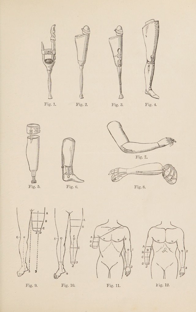 No text description is available for this image