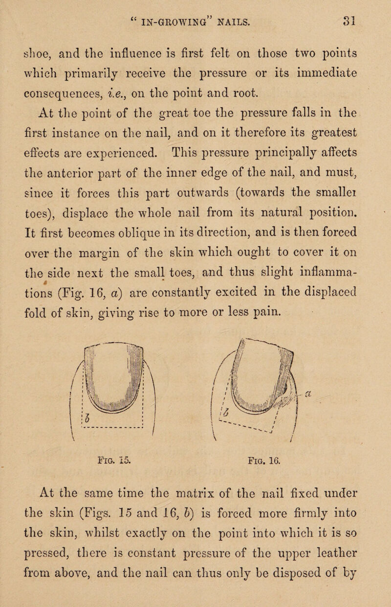 shoe, and the influence is first felt on those two points which primarily receive the pressure or its immediate consequences, i.e., on the point and root. At the point of the great toe the pressure falls in the first instance on the nail, and on it therefore its greatest effects are experienced. This pressure principally affects the anterior part of the inner edge of the nail, and must, since it forces this part outwards (towards the smallei toes), displace the whole nail from its natural position. It first becomes oblique in its direction, and is then forced over the margin of the skin which ought to cover it on the side next the small toes, and thus slight inflamma- i tions (Fig. 16, a) are constantly excited in the displaced fold of skin, giving rise to more or less pain. At the same time the matrix of the nail fixed under the skin (Figs. 15 and 16, h) is forced more firmly into the skin, whilst exactly on the point into which it is so pressed, there is constant pressure of the upper leather from above, and the nail can thus only be disposed of by