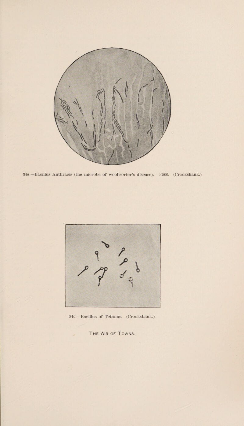 34a.—Bacillus Anthracis (the microbe of wool-sorter’s disease). X500. (Crookshank.)