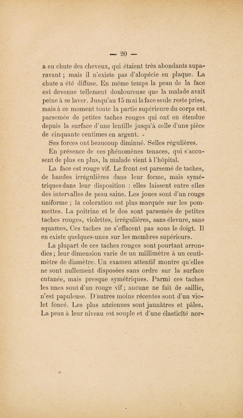 a eu chute des cheveux, qui étaient très abondants aupa¬ ravant ; mais il n’existe pas d’alopécie en plaque. La chute a été diffuse. En même temps la peau de la face est devenue tellement douloureuse que la malade avait peine à se laver. Jusqu’au 15 mai la face seule reste prise, mais à ce moment toute la partie supérieure du corps est/ parsemée de petites taches rouges qui ont en étendue depuis la surface d’une lentille jusqu’à celle d’une pièce de cinquante centimes en argent. Ses forces ont beaucoup diminué. Selles régulières. En présence de ces phénomènes tenaces, qui s'accu¬ sent de plus en plus, la malade vient à l’hôpital. La face est rouge vif. Le front est parsemé de taches, de bandes irrégulières dans leur forme, mais symé¬ triques dans leur disposition : elles laissent entre elles des intervalles de peau saine. Les joues sont d’un rouge uniforme ; la coloration est plus marquée sur les pom¬ mettes. La poitrine et le dos sont parsemés de petites taches rouges, violettes, irrégulières, sans élevure, sans squames. Ces taches ne s’effacent pas sous le doigt. Il en existe quelques-unes sur les membres supérieurs. La plupart de ces taches rouges sont pourtant arron¬ dies ; leur dimension varie de un millimètre à un centi¬ mètre de diamètre. Un examen attentif montre quelles ne sont nullement disposées sans ordre sur la surface cutanée, mais presque symétriques. Parmi ces taches les unes sont d’un rouge vif; aucune ne fait de saillie, n’est papuleuse. D’autres moins récentes sont d’un vio¬ let foncé. Les plus anciennes sont jaunâtres et pâles. La peau à leur niveau est souple et d’une élasticité nor- i