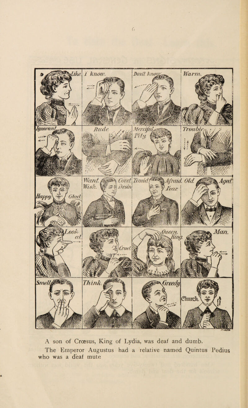 A son of Croesus, King of Lydia, was deaf and dumb. The Emperor Augustus had a relative named Quintus Pedius who was a deaf mute