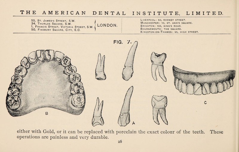 55, St. James’s Street, S.W. 1 34, Thurloe Square, S.W. ( . n M HH M 1, Francis Street, Victoria Street, S.W. ( L-'~'IN IN 50, Finsbury Square, City, E.C. ) Liverpool: so, rodney street. Manchester: io, st. ann’S square. Brighton: 123, king’s road. Bournemouth: the square. Kingston-on-Thames: 25, high street. either with Gold, or it can be replaced with porcelain the exact colour of the teeth. These operations are painless and very durable.
