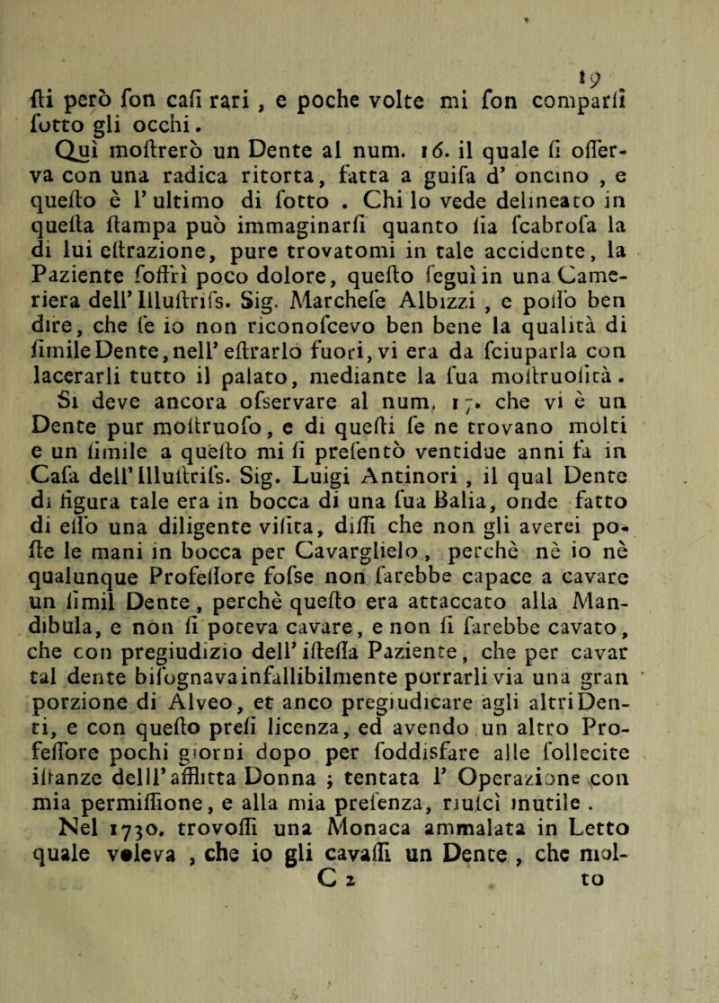 *9 fti però fon cali rari , e poche volte mi fon comparii fotto gli occhi. Qui inoltrerò un Dente al num. 16. il quale fi ofier- va con una radica ritorta, fatta a guifa d’ oncino , e quello è l’ultimo di fotto . Chi lo vede delineato in quella ftarnpa può immaginarli quanto ila fcabrofa la di lui eltrazione, pure trovatomi in tale accidente, la Paziente foftiì poco dolore, quello feguìin una Came¬ riera dell’ lllultrifs. Sig. Marchefe Albizzi , e pollo ben dire, che le io non rieonofeevo ben bene la qualità di fimileDente,nell’ eltrarlo fuori, vi era da fciuparla con lacerarli tutto il palato, mediante la fua mofiruolità. Si deve ancora ofservare al num, i che vi è un Dente pur moltruofo, e di quelli fe ne trovano molti e un limile a quello mi fi prefentò ventidue anni fa in Cafa dell’illuilrifs. Sig. Luigi Antinori , il qual Dente di figura tale era in bocca di una fua Balia, onde fatto di elfo una diligente vifita, dilli che non gli averei pò* He le mani in bocca per Cavarglielo, perchè nè io nè qualunque Profellore fofse non farebbe capace a cavare un limil Dente, perchè quello era attaccato alla Man- dibula, e non fi poteva cavare, e non fi farebbe cavato, che con pregiudizio deirillelìa Paziente, che per cavar tal dente bifognavainfallibilmente porrarli via una gran porzione di Alveo, et anco pregiudicare agli altriDen- ti, e con quello prefi licenza, ed avendo un altro Pro- felfore pochi giorni dopo per foddisfare alle follecite ifianze delll’afflitta Donna ; tentata V Operazione con mia permiffione, e alla mia prelenza, riuicì mutile . Nel 1730. trovoffi una Monaca ammalata in Letto quale v#leva , che io gli cavalli un Dente , che mol-