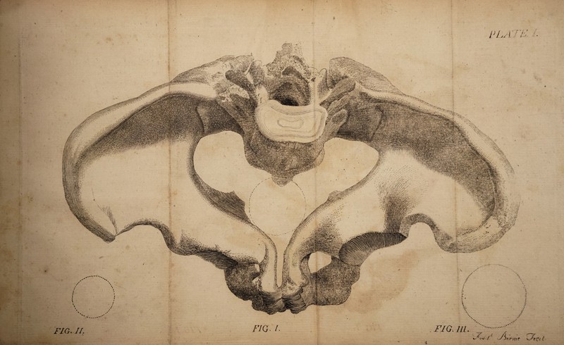 fT~~ ... FIG. II. I? LAI ' h' . FIG. ILL. FIG- /.