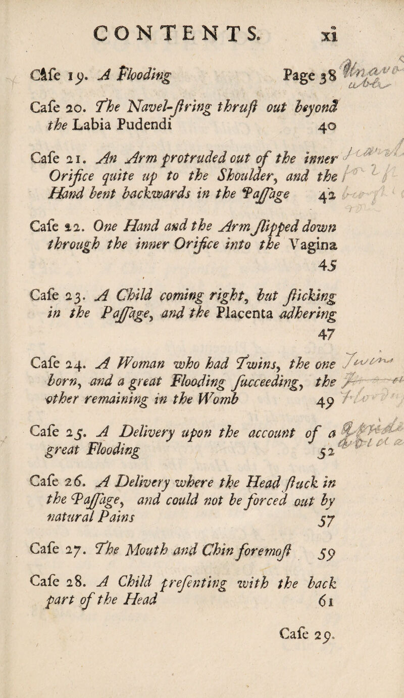 Cftfe it}. A Plodding Page 3S Cafe 20, The Navel-firing thru ft out beyond the Labia Pudendi 40 Cafe 2i* An Arm protruded out of the inner Orifice quite tip to the Shoulder, theft1’ Li Hand bent backwards in the fajfage 42 11 Cafe 12. One Hand and the Arm flipped down through the inner Orifice into the V agina 45 Cafe 23. A Child coming rights but flicking in the Pafiagey -and the Placenta rubbering 47 Cafe 24, A Woman who had Twins3 the one bornj •and a great Flooding fucceedtngj the other remaining in the Womb Cafe 25* A Delivery upon the account of a great Flooding 5 2 Cafe 26”. A Delivery where the Head (luck in the FaJJage5 and could not be forced out by natural Pains 57 Cafe 27. The Mouth and Chin foremofi J9 Cafe 28* A Child preferring with the back part of the Head 61