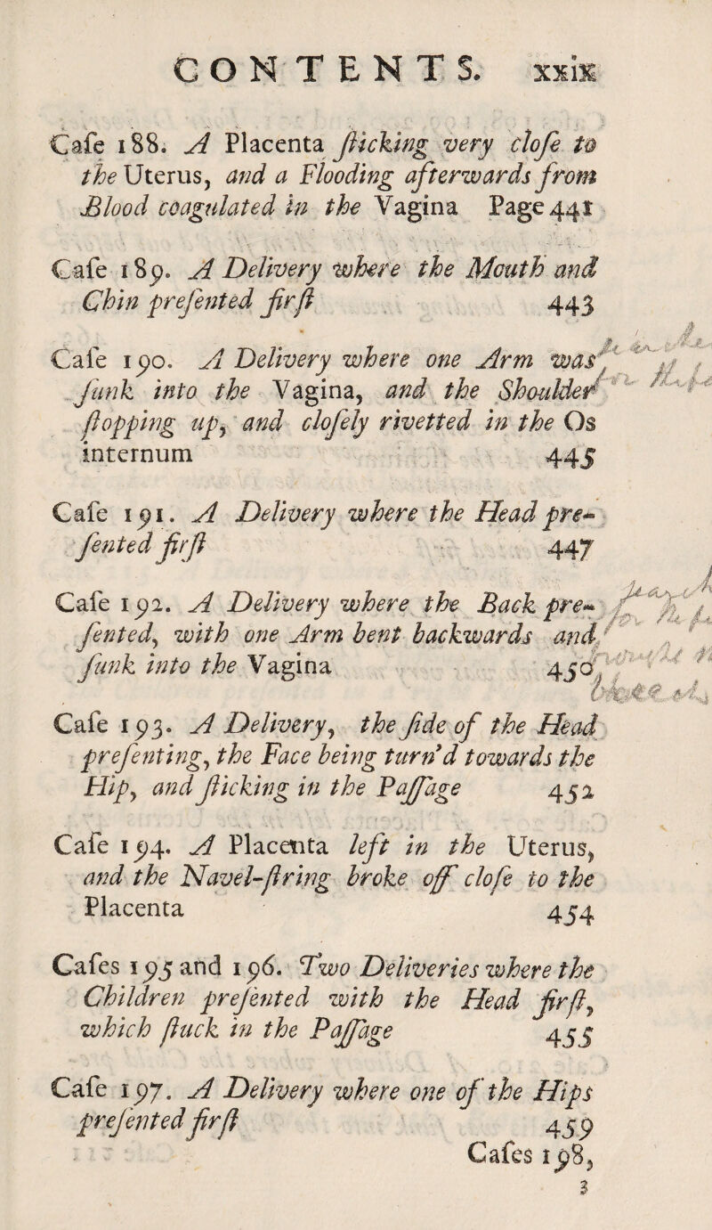 Cafe 188. A Placenta picking very doji h /^Uterus, and a Flooding afterwards from Blood coagulated in the Vagina Page 441 Cafe i8p. A Delivery where the Mouth and Chin prejented firft 443 J, A >, 4a... Cafe 15)0. A Delivery where one Arm was, f funk into the Vagina, and the Shoulder ^ flopping up, and clofely rivetted in the Os internum 445 Cafe 191. A Delivery where the Headpre+ fented fir ft 447 Cafe 1 £2. A Delivery where the Back pre* z''* -f • y - 7 of X 9 ^ r i fented, with one Arm bent backwards and funk into the Vagina 45° Cafe 193. A Delivery, the fide of the Head prefenting, the Face being turn d towards the Hip, and ficking in the Fajfage 45a . #4 sj Cafe 1^4. A Placenta left in the Uterus* and the Havel-ft ring broke of clofe to the Placenta 454 Cafes 1 £5 and 1 p6. Fflwo Deliveries where the Children prejented with the Head fir ft, which ftiick in the Pajfage 43:5 Cafe 1 yy. A Delivery where one of the Hips prejented fir ft Cafes if,