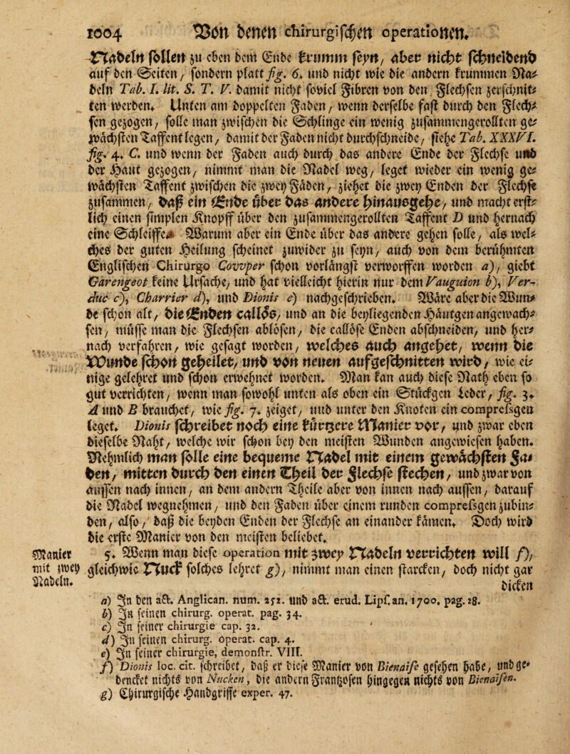 Sanier mit uret) fabeln* 1004 33ön benct) Chirurgien Operationen, TTrt&eht follett ju eben bern ©tbe tnimm feyit, 4&ee nicht jchrteifcettfc auf 5cn (Betten, fonbern flau fig. 6, unb niept me Me andern frummen beln Tab. L lit. S. T\ V. bamit niept fovielgtbren von ben §fcd>fcn jerfdmit* ten Werben* Unten am boppeften $aben, wenn berfefbe faji burcl> ben gfeep* fen gezogen/ foffc man jwifepett bie ©dffinge ein wenig jufammcngerolftcn gc* tvaepff cn Waffen* fegen, bamit 5er gaben nic|f burepfdmeibe/ ftefyc Tab. XXXTL fig. 4, C nnb wenn ber gaben auep burep ,bao anbere Snbe bet gfeepfe uiif> ber $aut gezogen/ nimmt man Me Stabet ms, feget wieber ein wenig ge* tt>ad>|icn €afent $wifd?en bk $wcp gaben, fiepet bk jwep Snben bet Sfedff* §ttfammcn, fenf* ein (gnbe übet feus andere fyinauegefye, unb macptcrjfr liep einen flmpfen j?nopff über ben ^ujammengereiften ‘Saffent D unb pernaep eine @<pfeiffe** 28arum aber ein Snbe über bas andere gepen foCfe / afe wef* d>co ber guten Reifung fcpcinet $uwtber ju fepn, auep von bem berühmten (Engfifcpcn Chirurgo Cowper fepon vorfangff verworflfen worben d), giebt Garengeot feine Urfacpe/ unb pat vielfetept hierin nur bexnVauguion b), Terv. äiio c), Charrier d), xtnb Bionü e) naepgefeprieben* Sßarc aberMeSBmt* be fd;on aft, i>iei£nbett unb an bie bepftegenbenJpaufgenangemacf)^ fc n, muffe man bie §Iecpfen abfofen, bie caffbfe Sn ben abfdmetben, unb per* naep verfapren, wie gefagt worben7 welches äticfr angelet/ werm feie XVnnbe fcboit gesellet, wnfe wn neuen aufgefchnitten wivfe, wie et* nige gclepret unb fepon ernennet Worben* 9)?an tan and) Mefe 3}atp eben fo gut vemdKcU/ mnn man fowopl unten afo oben ein ©tücfgcn ieber, fig. 3* A unb B brauebef/ wie fig. 7* geiget/ und unter ben J?uofen ein compreßgen fegen Dionis jefcrabet nodb eine tftvt$cte iYianiev v$v, ifnb §war eben Mefefbe Öiapt, wefepe mir fepon bep ben meiffen SBunben angewiefen paben* SBepmliep man (olle eilte bequeme ttabel mit einem gewaefefiett feen, mitten buvd) feen einen €f?eil feen Jlectffe (fec&en, unb^marnon aufen nad) innen, an bem anbern 5:|eife aber von innen naep auffen7 barauf Me Sßabcf megne^meU/ unb ben $abcn über einem runben comprefsgcn §ubin* ben, affo, baff bie bepben Snbcn ber Sfed^fe an einanber famem sSod) mirb bie erjic Sanier von ben metjien beliebet^ 5. 5SJcnn man Mefc Operation mit $toey r?4feelrt ^euviefeten will f), gfcicpmtc V%U$ folcpeo le§ret g), nimmt man einen ffarcfcit/ botp niepf gar bieten ä) 3n ben aÄ. Anglican. mim. 272. unb a&. erud. Lipf.an, 1700. pag.2g. b) 3n feinen Chirurg, operat. pag. 34. c) 3n feiner Chirurgie cap. 32. ' d) 3fu feinen Chirurg, öperat. cap. 4. e) 2fn feiner Chirurgie, demonO:r, VIIL f) Diouts loc. dt. fcpreibel, Dag er tiefe ^anier von Bienalfe gefefem fea^e, nntge*» bendef niepu? ron Nucken, bie anbern grangofen Mn^egen m Biendfin. g) Spirurgifcfee ^>anbgrijfe exper. 47.