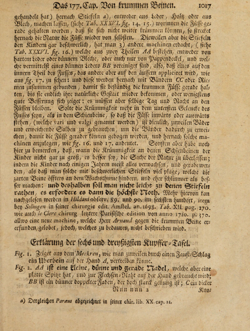 gc^anbcft bat) (jernad) ©tiefefit a), entweder aus leber, Jpof^ ober aus Sied), mad)cn fajfcn, ({leihe Tab. XXXVLfig. 14. 15.) werinnen bk Suffege; rabc gehalten weiten, baß jte fid) nid)t weiter: frummen lernten, fo (t re cf et hernach bie 9lattfr bk Suffe wieber Don felbflett* 3)kwcifcn aber bk ©riefeln ben jvinberngar befd)wcrltd), bat man 3) anbere machincn erbaebt, (ftelje Tab. XXXTI. fig. 16.) wefd)e am jwei) Reifen AA befielen, entweder Don hartem lebet ober bimnem Slcd)e, ober and) nur Don Cpappcn beeid, unb wet d)e Denn i ttc fjl eines bannen lebers BE vereiniget fmb, affo, baß eines auf beit innern ‘Jfteil bcs Suffees/ bas» anbere aber auf ben äujjern appliciret wirb, wie am fig. 17* ja feiert i unb biefe werben hernach mit Sänbern CCobcr 0?ic^ men jufammen gelumbcn, bamif fle beßänbig bic frummen ^ülJe aerabc \>aU ten, bk fic enbltd) if>re natürliche ©cjlait wicber befommen, ober wcnigßens gute Seffertmg fid) jeigef: es muffen aber fettige 5ag unb 9ladt an ben gaffen bteibem ©ölte bic Ärummigfeit mcf)r in bem unterften ©efenefe bcs guffes fepn, als in bem Schienbeine, fo baß bie güffc inwärts ober auswärts flehen, (welche vari unb valgi genannt werben) iß bienlid), juweifenSaber unb erwekhenbe ©afben ju gebrauchen, um bic Sauber babureb ja erwek d)cn, barnit bie gaffe geraber fbnnen gebogen werben, unb hernach folche ma¬ chincn anjulcgen, wie fig. i6> unb 17» anbaiUt. ©onfren aber habe noch hier ju bemerefen, baß, wann bie Ärummigfcir an benen Schienbeinen bet «Äinber nid)t gar ju groß, es beffer fei), bie ©ad)c ber 91afat ju ubcrlgffcr inbem bie itinber nad) einigen fahren meiff attes oerwad)fen, unb gerate wer ben, als baß man foldx mit befd)wcrlicben ©tiefeln Dtel plage, welche tnc jarfen Seine offters an bem 5Bad)St(u?me {mtbern, unb eher fdßimmcr als beß fer mad)en: unb brsJ^tlbm {oll mutt niefrt leidyt 31t benen Stiefeln tattern/ cs erfordere es tarnt bie fyvcbfte Hot!?* 9>lefr hiervon fan nachgclefcn werben in Hildaniobferv. 89* unb 90* im fechßcn Rimbert, item bet) Solingen in feiner Chirurgie edit. Amftel. an. 1698* Tab. X1L pag. 270. wie and) leQlerc Chirurg, (elftere ^)arijifd)C edition von anno 1720. p. 370. attwo eine neue machine, weld)c Jjberr Amaud gegen bie brummen Seine er; erfunben,gelobet, jebod), welches ju bebauten, nid)t befd)rieben wirbt ©ftärung ter fw&sunb bret>§iöffcn Äupffav^afd. Fig. 1» getgef aus bm'Meekrcn, me man juredfeut>urd>einengaufd@d)lag ein Überbein auf ber 4?«nb A, vertreiben fömtd Fig. 2. AA ift eine Heine/ bärmeuttb tferabe wcfcfjc abereine pf.’tCc @pifjc (jat, imt> jur §(cd)fcii sDiafjt auf 5er ipatib gcbrattdjf unrb; BB i|t du büuncr boppef(ergaben, ber bcd> ftarcr gemmg ifij Cejnbiefer 97 nn itan 2 jtnoe o) SeräUit^en Paraus «Dgejci^nd in fein« chk, lib. xx.cap. u. h * y