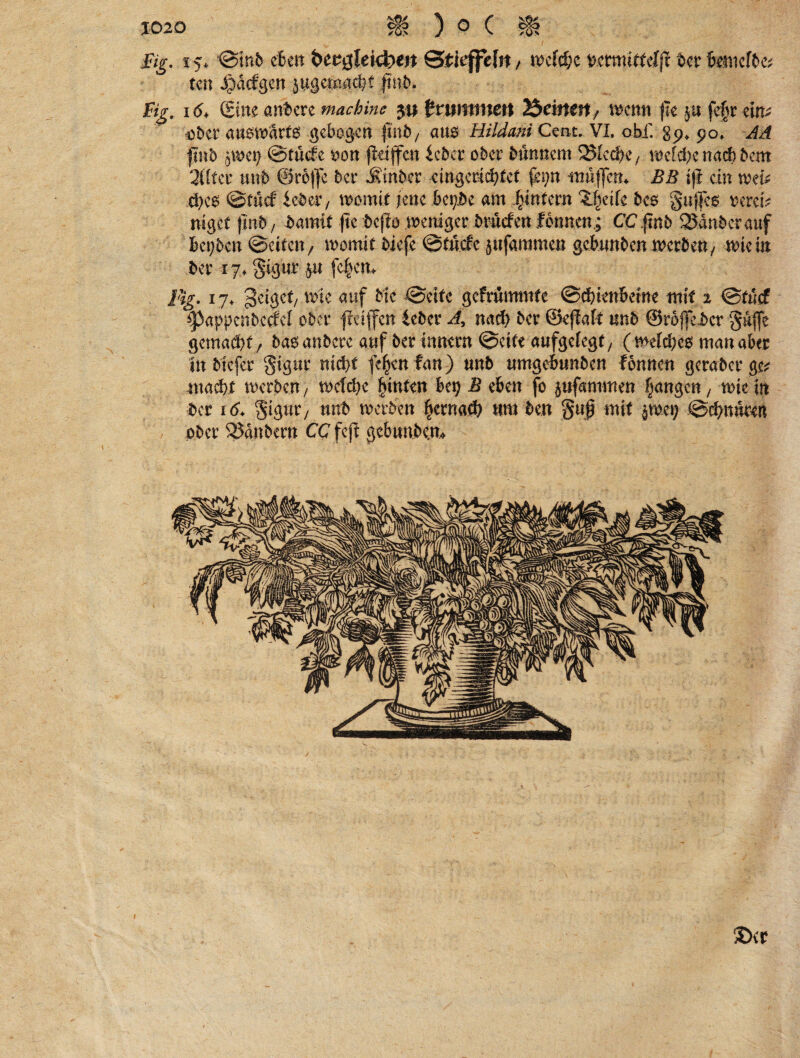 £ig. 15* Stnb eben berglekhtrt Stieffefn f weiche t?emwtfcf|t ber teuefbe* ten Jpacfgen jugermüht ftnb. %• I(5+ Sine andere machine $u brummen 25ektctf/ wenn fle $u fe§r ein; ?öbcr auswärts gebogen ftnb; aus Hildani Cent. VI. obf. 89* 90. Ad ftnb $wet) Stucfc oon jteijfcn lebet ober bunnem Sieche/ welche nach bem 2(lter «nb ©reffe ber Äinber eingerichtet ferm -muffen^ BB tff ein tvefe eh cs Stucf lebet/ womit jene bepbe am ^intern ‘Ufjeife bes Suffes terei; nigef find / bamtt fte bcjto .weniger bruefen formen ; CC find Sauber auf bepben (Seiten / womit biefe Stuck jufammen gebunben werben/ wie in ber 17> §igur ju fc|en> Bg. 17. geiget/ wie auf bk Seite gcfrümmfe Schienbeine mit 2 Stucf *pappe«becfef ober fkiffc« leber d, nach ber ©ejWt nnb ©roffeber gufle gemacht / basanbere auf ber innern Seite aufgefegt/ (welches man aber in biefer gtgur nicht fe^enfan) nnb umgebunben fonnen gerader ge^ wacht werben t wcfche hinten bei; B eben fo jnfammen fangen, wie in ber 16* Sigur) nnb werben hernach um ben §u$ mit jwei; Schnuren ober Säubern CC fcjt gebunbew ©er