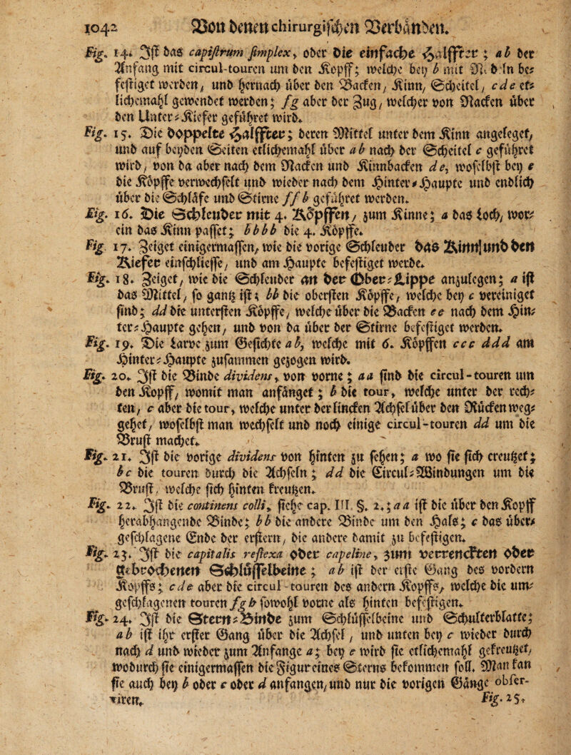 104a 23on bene« Chirurgen 23<rbdn^ti. » §ig« 14* 3P ba$ capißrum fimplex> ober Oie einfache ; ab ber Anfang mit circul-touren um ben Jx-pff; wefebe bet; b mit 91-. Mn bc? fepiget werben* unb ficrnad) über ben SSaifen/ Ättut/ ©ebeitef y ede et* fid)ema£f gewenbet werben; fg aber bet: 3«3/ t^efc^er Port Skefen übet ben Unter* liefet gefü^ret wirb* 15* Sie doppelte ; bereu SSittef unter bem Ätnn angefeget, unb auf bepben ©eiten etficbemabf über ab nad> ber ©ebeitef c gefügtet wirb, von ba aber nach bem Suaden unb Äümbaefen dey wofefbp bet; # bte j?6pffe t)ermecf)fe[t unb wieber nach bem hinter#Raupte unb enbfiep über bk ©epfafe unb ©time ff b gefaltet werben* &g 16. SDie Sdbfeufcer mit 4* Ä§pffm/ $um üinne; a bae loci)/ wor* ein bao jttnn paffet; bbbb bie 4» itbpffe* % *?♦ Berget emigcrmajfcn, wie bie vorige ©cbfeuber t>W$ Äitttt!untren liefen emfc^Uejfe/ unb am Jj>aupte befeptget werbe* 1%* *8* feiger, wie bie ©cbfeuber m fcer <Dbee*itippe anjufegen; * ip bao SDtittef* fo ganp ip; bh bte oberfien jlbpjfc, wefebe bep c vereiniget pnb; ddbk unterpen Äbpffc/ wefebe über bie 95acfen ee nach bem $in* ter* Raupte gehen* unb von ba über ber ©ttrne befeptget werben* Fig. 19* Sie larve pm ©epcbted£; wefebe mit 6* .Köpfen ecc ddd am hinter Raupte jufammen gezogen wirb. Fig. 20+ 3P bie QStnbc dividem y)>on vorne; aa pnb bie circul-touren um ben Äopff/ womit man anfünget; b bie tour „ wefebe unter ber recb* Uw, c aber bie tour* wefebe unter ber finefen 2(cbfef über ben 9{ücfen weg* ge^ety wofefbp man weebfeft unb nod) einige circul-touren dd um bie 93rup machet L ' 21 > 3P bie vorige dividenr von hinten ju feiert; & wo pe pcb creu^et; bc bie touren bureb bie 2fcbfcfn; dd bie £trcuf*2Btnbungen um bie S5n?p, wefebe pcb hinten freuten* Fig. 22* 3P bie continem colli* pefje cap. UL §, t>\aa ip bie über ben.Kopf berab!)angcnbc 25mbc; bb bie aubere QStnbc um ben Jpafo; c ba$ über* gefebfagene ©nbe ber erpent/ bie anbere bamit 511 bcfepigen* Big» 2g* 3p bie capitalis reflexa $öcr capeline y $um VZTXtWdUttft O&er g<bro4)enett Sd)lujfell>eine ; ab ip ber erpe ©ang bco vorbern Äopffo; cd# aber bie circul - touren bc$ anbern jtopff^ welche bie um' gefddagenen touren j^-^fowo^f vorne afo Junten bcfepigen* ftg* 24. 3P bte ©tcrtt-öirf&e 5um ©d)füfp[bcinc unb ©ebufterbfatte; ab ip i§r erper ©ang über bie 2tcf>fcF, unb unten bep c wieber bureb nach d unb wieber &um Anfänge a; bep c wirb pc etfitbemabf gefreuftet/ wobureb pe einigermaPen bie §igurcmc^ ©Cern^ befommen fofl SSRanfan fte Mfy bep b ober c ober d anfangen/ unb nur bie vorigen ©ängc obfer- wen*. ' • F*g-25♦