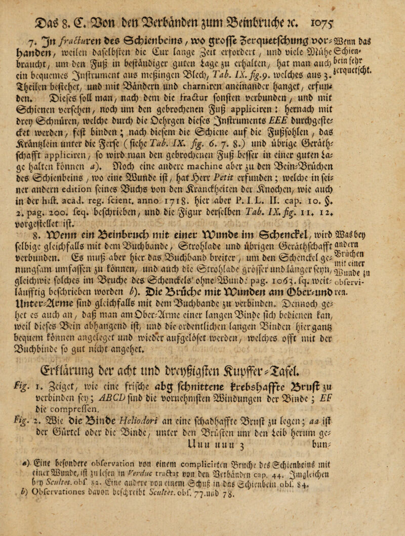 7* 3»t frattuvtn fce<5 ©cfeietibeiite, wo gt'ofle Sct'<|»etfct>«it0 voz* 2Bemt m f)4nt>ert/ wetten bafelbftcn Die (Eur lange 3ett erfordert, unb mete SDW§e6cf;ie^ braucht, um ben guj^ in beflättbiger guten iage^u erhalten, l^at man aud)&etnW;v ein bequemes ^Kfdumcnt aus me^tngen SSlcd), Tal?. IX. fig.9. welches aus ^äa'ctuct!cvt< feilen begehet, unb mit 23anbcrn unb chamiren aneinanber fanget/ erfum ben* SMefes foll man, nad) bem bie fra&ur fonjien txrbunben , unb mit ©ebtenen ücrfel)en, noch um ben gebrodenen guß appliciren : £ernad) mit bre^ ©ebnüren, welche burd) bie Delwgcn biefes 3nfiruments EEE burcbgejic; det werben / feß binben ; nad) btefem bie ©djicne auf bie gußfolßen , bas Gränfclcin unter btc §erfe ( fte^c Tab. IX. fig. 6* 7. 80 unb übrige ©eratf^ febafft appliciren, fo wirb man ben gebrochenen §uß fceffer in einer guten ia; ge Ratten fonnen afi STcod) eine anbere machine aber gtt ben 25cim$3rüd)cn bes Schienbeins , wo eine Söunbe iß, fsat iperr Petit erfunben; welche infet* ncr anbent edition feines 33ud)S t>on ben Grundzeiten bei Gnocbcn, wie aud> ' in ber hift. acad. reg. feient, anno 1718» tyw a^cr P* I L. II. cap. io* §♦ 2* pag. 200* feq. betrieben, unb bie §igur berfclbcn Tab. IX. fig. m 12«. horgeßellet iß«. 8* Wenn ein ISeinbtud) mit einet t£>imbeim ScfeeticFel, wirb BBaSbep fclbigc gleichfalls mit bem QJucb&anbc, ©fro^tabe unb übrigen ©erathfebafft anocvit tterbunbem (Es muß aber hier bas.23udjbanb breiter, um ben @d)endet ge; mtngfam umfaßen $u fönnen, unb and) bie @trot)Iabe großer unb tangerfet;n,^Uube ja gleichwie fotd)es im Bruche bes @d)endels? o^ne Sßunbe pag. 1063*fq. weif; obfervi- läufftig befebrieben worben b). foielSvucbe mit Wunben am (bbetmnbm. Untet'2{tme jmb gleichfalls mit bem33ud)banbc §u oerbinberu Sctmocb ge; fyct cs auch an, baß man am Oberarme einer langen 35inbe ßd) bedienen f an, weil biefes 525ein ab^angenb iß, unb bie orbentlicbcn langen Sßtnbcn Ißerganfc bequem fonnen angeleget unb wieder aufgefofet werben, welches offt mit ber 23ucbbinbe fo gut nid)t angelet (Srffarung Per acht unb bra)$gf?m ^upffer*Xafd. %• I. geiget, wie eine frifefje <?bg fdjititterte tcebslyaffte 25rußf|u Derbinben fei); ABCDfmbbk ttornclrmißenSSBinbungcn beraube; EP bie compreiTen. Fig. 2. 3Bie die 53iude Heliodori an eine fcbabfjaßte 35ruß $u legen; aa iß ber ©ürfcl ober bie 23inbc, unter ben Prüften um ben ieib herum ge; Uuu uuu 3 bum ») (Eine befonbere obfervation ron einem complicirfen 55rttcf)e bes' 0cbtenbcin$ mit einer2Bunbe,i|] ^liefen in Verduc traftat ron ben 23crb«r.b»tn cap. 44. ^mgldcbftt l^P Scultet. obf !>2. 0ne anbere ron einem @cj)»§ in bae ^ebienbem obi'. 84., b) Obfervariones babOU befefreibt Scultet.'obf, 77.unb 78,