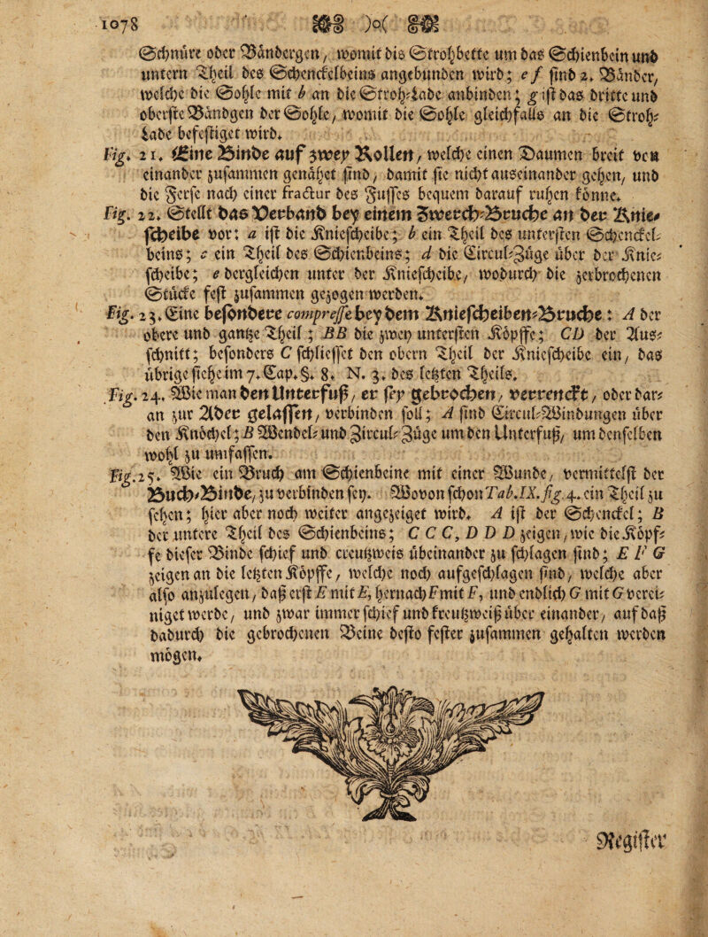 ©chnüre ober 35anbergen, womit Mo ©tre^bette um dag @d)ienbcin und untern ^etl des ©chemfclbeino angebunden wirb; ef pnd 2* Ständer, welche bte ©oMc mit b an bic @tro^4abe anbinben; gi|i das- dritte und obcrjfcS5anbgcn bcr@o^fc/ womit bie @of)fe gleid)fa{& an die ©trofy? iabe befepiget wirM %♦ 21, ÖJine 75inbe auf $trey Köllen, welche einen Saumen breit t>cn einander jufammen genaset pttb/ damit pe nichtauoeinanber ge^en, und bie §ccfe nach einer fra&ur des Suffes bequem darauf ruhen fenne* %» 22. ©tetft tmo Verband bey einem 3tvevd);25vuche an bet Knie* febeibe rot: a tp die jvuicfcheibc; b ein 3.|eit bco unterpen ©chenaeb beim?; - ein “J^eif des (Schienbeins; d die Sireubguge über der Jvnte* fd)eibe; e dergleichen unter der jhuefcheibe, wodurch die erbrochenen ©tutfe fep ^ufammen gezogen Werbern Hg- 23* (Eine befon&ere comprejfebeybtm Kniefcheibem23ruche t A der obere und gaW$e?hcd? bie $wcp unterpen J^dpffe; CD der 2lu$? fchnitt; befonders C fehlte jfet den obern ?i)eil der itniefcheibe ein, das übrige pehetm 7* Qtap*§* 8* N. 3» des festen ^(jeifev fig. 24* SBic man Öen Unterfwp, er fey gebrochen/ tterreneft / Oberbau an ^ur 2ibcr gelaßen, verbinden foll; A (Inb SircubSBinbungen über den $ned)el; B 2Bcnbeb und gweub 3üge um den Untcrfup, um benfetben wo^t $u uwfaffcn. fig;i5» SBie ein 2Jrucb am (Schienbeine mit einer SBunbe, rermittefp der 25uch'Bin&e, ju verbinden fcp* SBotwn ffyonTabJX.fig^cin ^eit $u fcljen; Ijier aber noch weiter angejcigef wirb* A iji der ©chcncfcl; B der untere £|eü des ©chienbeins; C C C9 D D D geigen, wie dieÄopf? fe biefer 33inde fchief und crcuhwets übeinander §u phfagen find; E F G geigen an die lehren Äopffe r welche nod) aufgefdpagen pnb , welche aber alfo amufegett, daf erpi'imit^hernachFmitF, undenbüd)*?mitGderen nigetwerdC/ und §war immerfci>icf undfreuhweipüber einander/ aufbap dadurch die gebrodenen heitre depo feper jufammen gehalten werden mögen* SJftgifla4